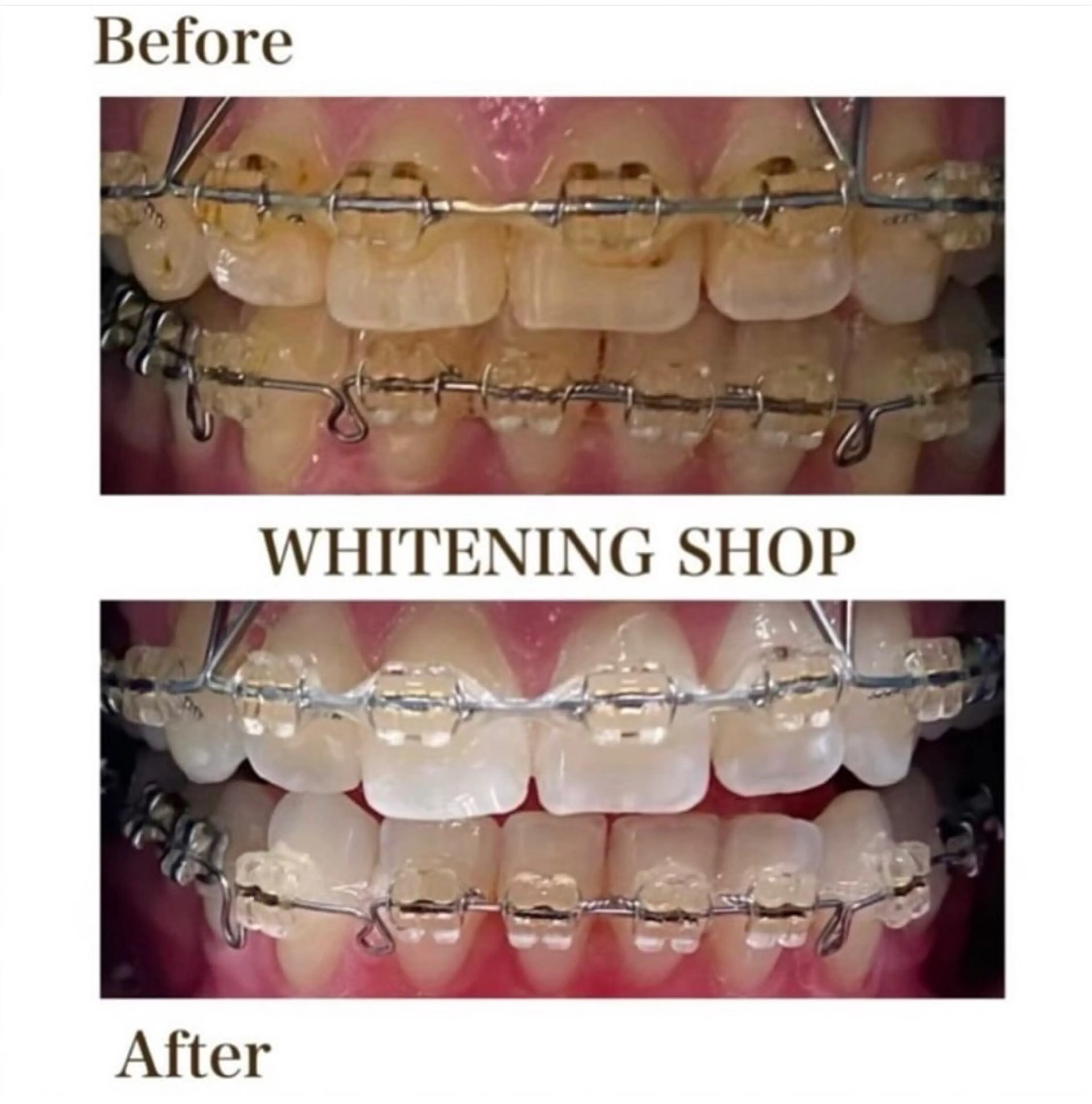 ホワイトニング ショップ伊丹店のその他イメージ