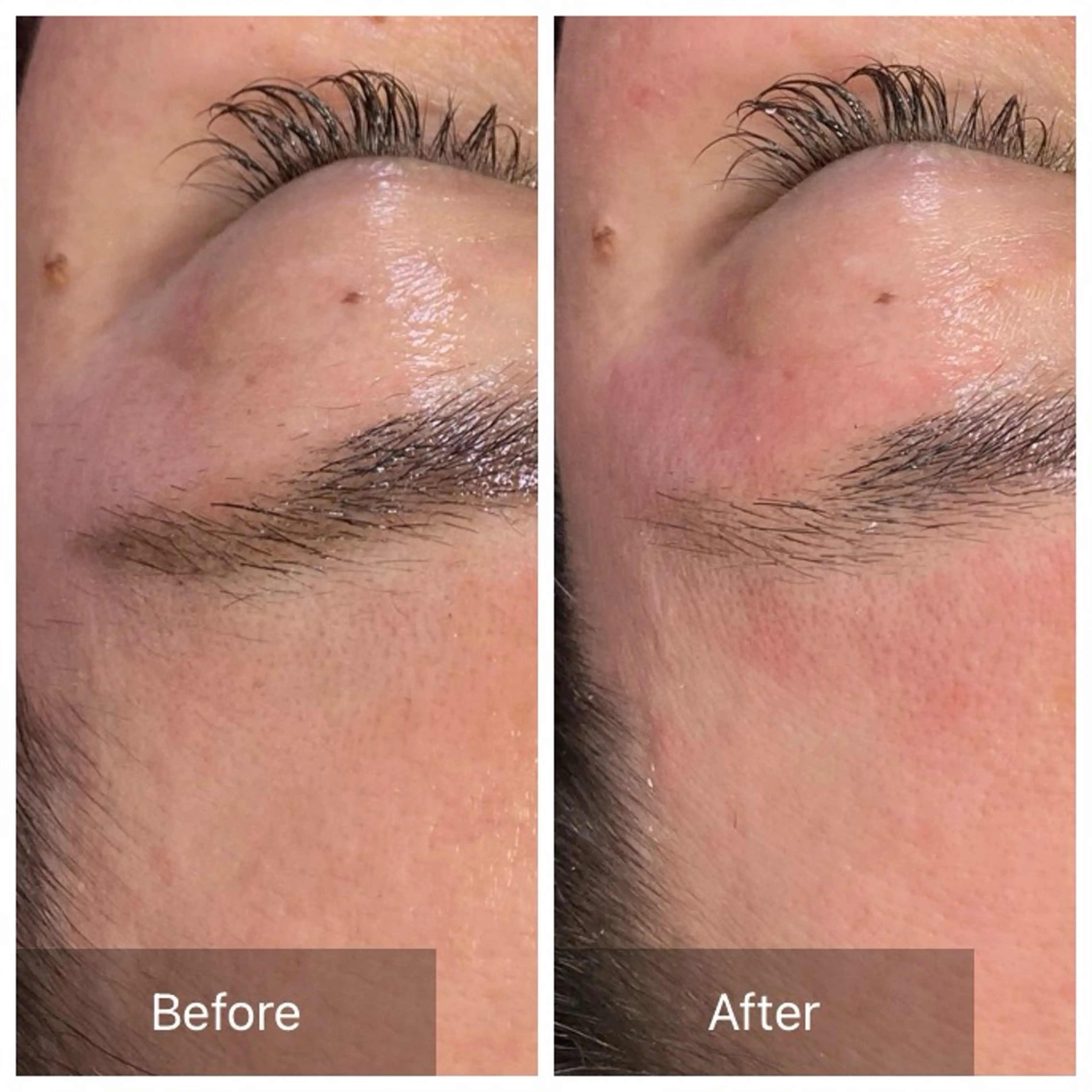 アイブロウ 脱毛 産毛専門店 Bittoのエステ・リラクイメージ