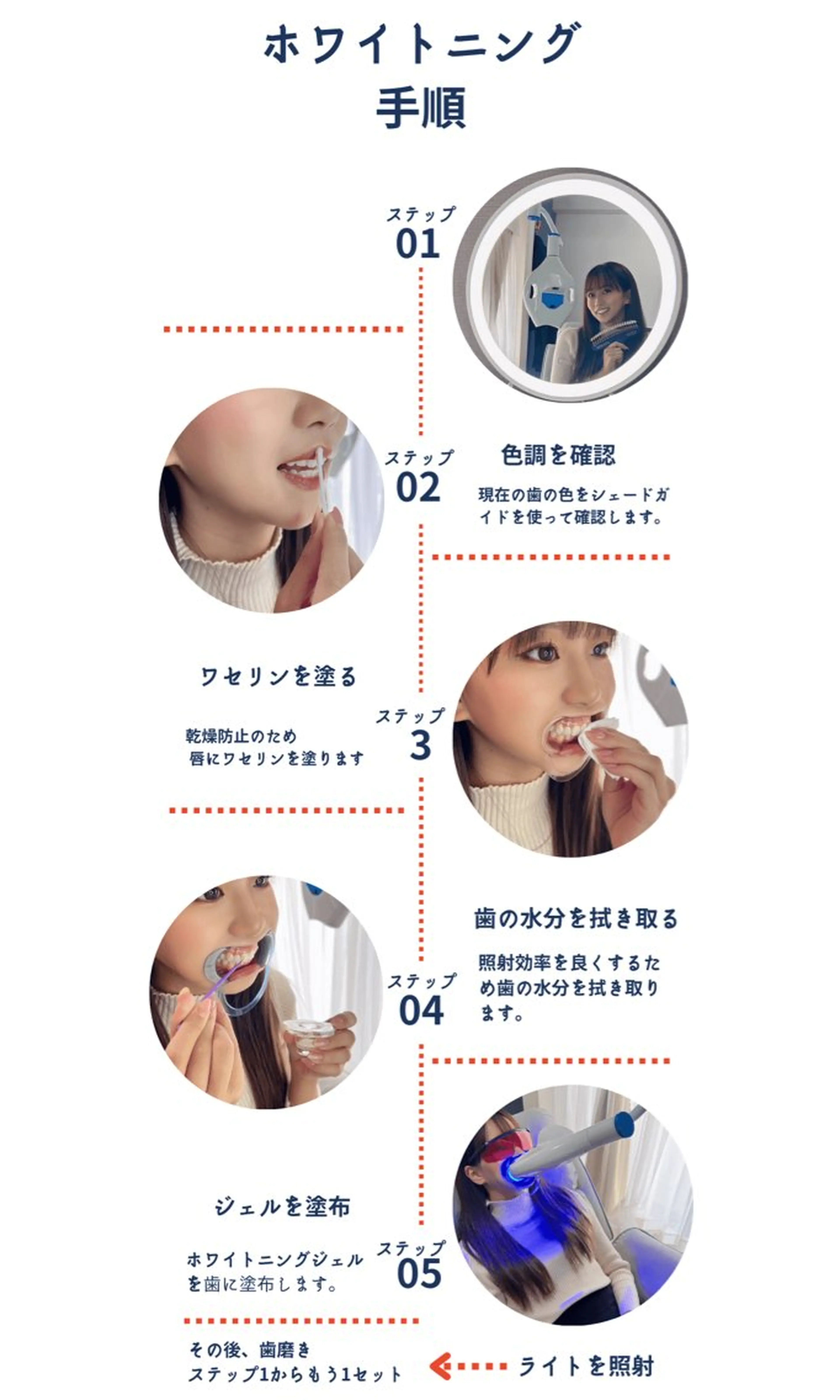東区香椎歯のセルフホ ワイトニングGLOWのその他イメージ