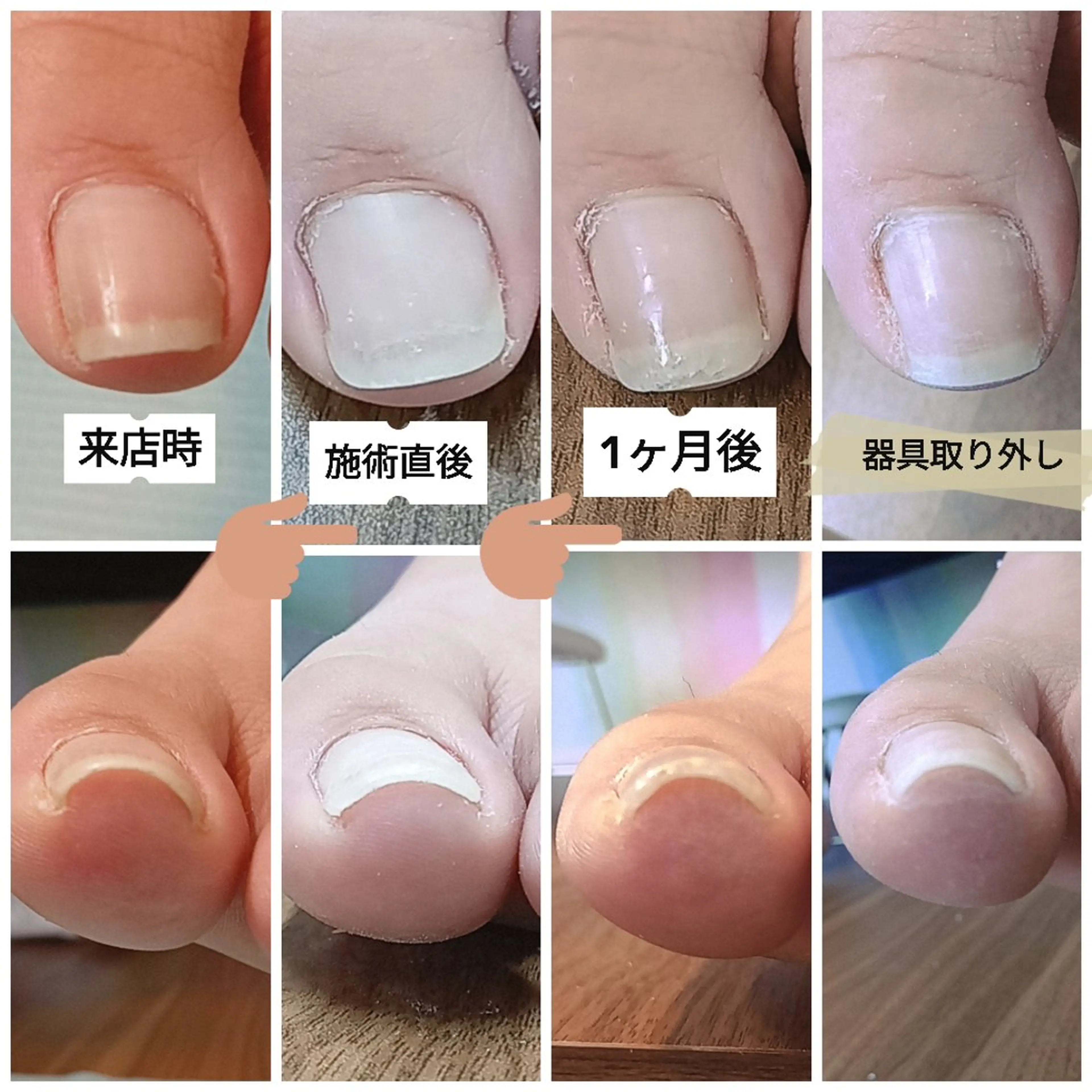 ネイル その他 フットケアルーム ~KaPilina~のネイルデザイン