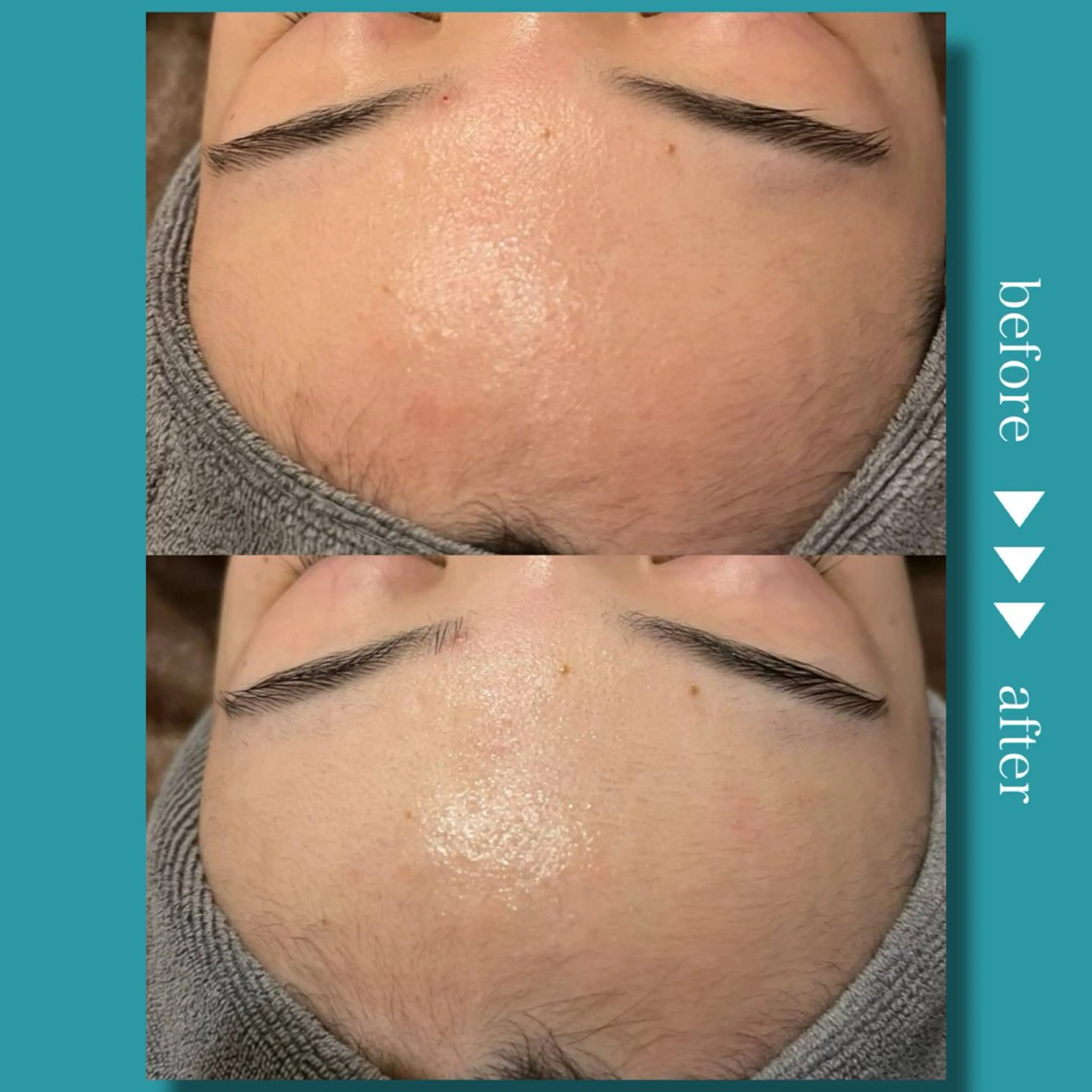 小顔コルギ ☆表参道/外苑前のエステ・リラクイメージ