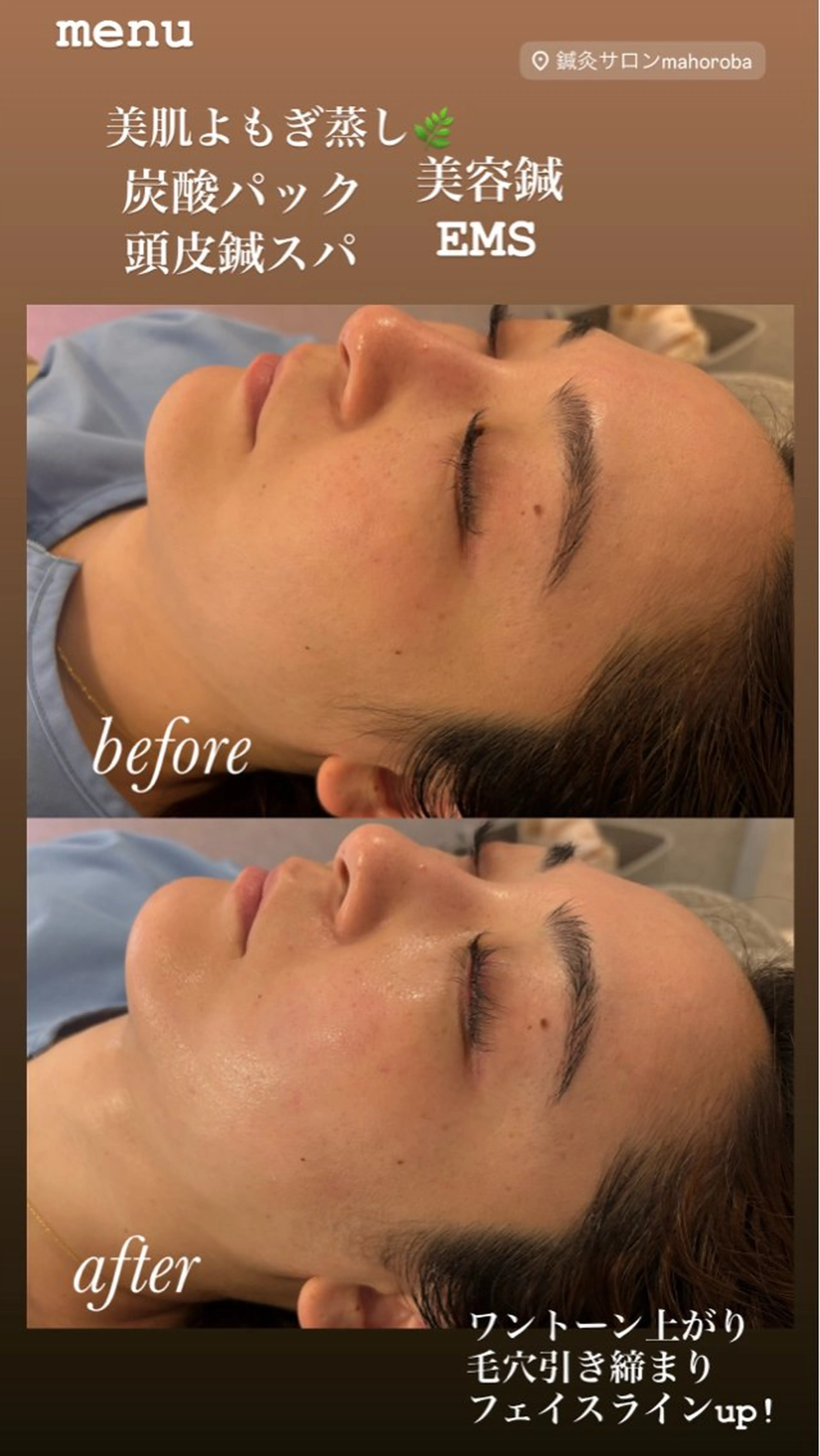 エステ リラク 美容鍼灸サロン mahoroba院長のエステ・リラクイメージ