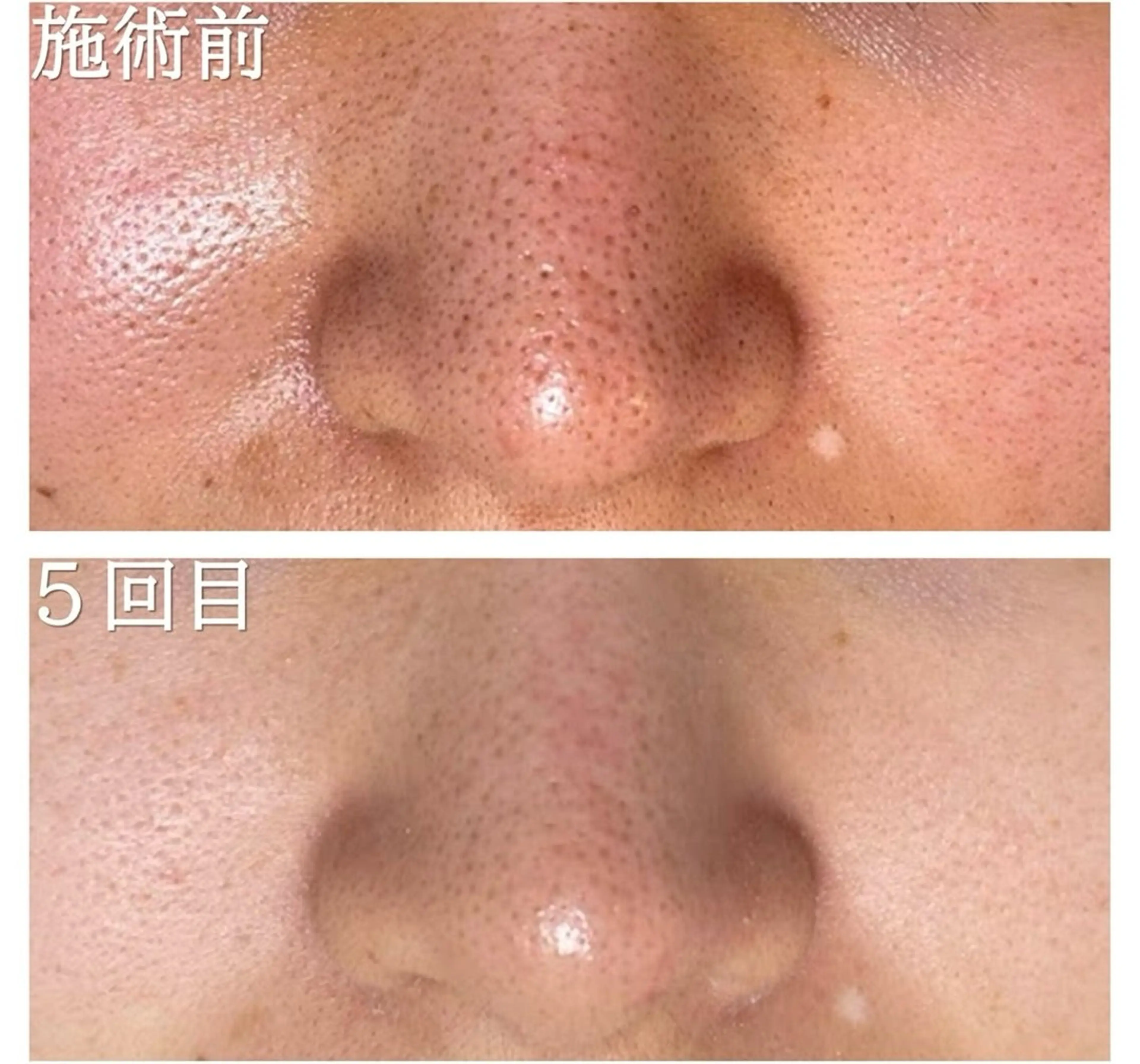 Rejuve ﾘｼﾞｭﾍﾞのエステ・リラクイメージ