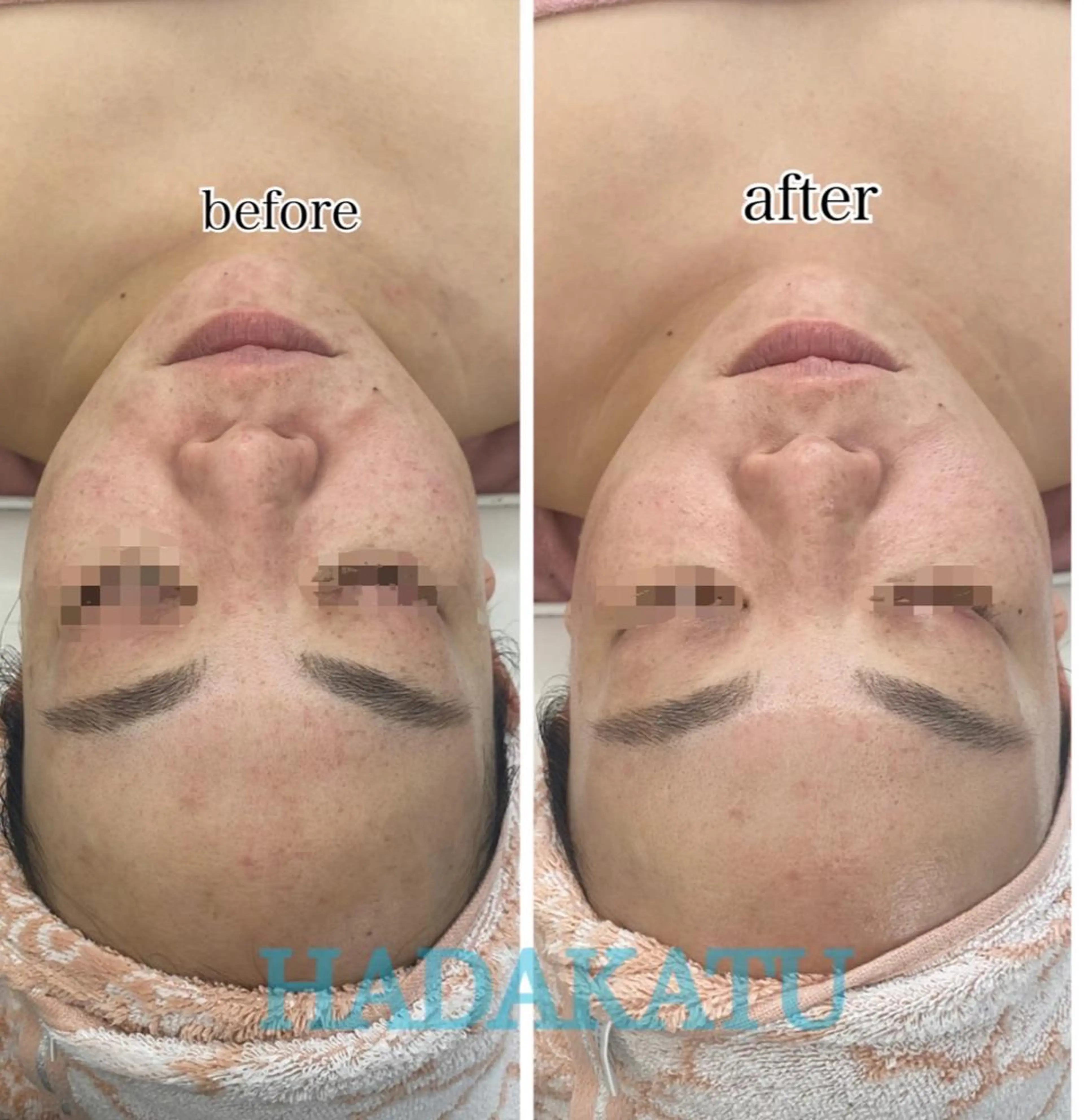 総合エステサロン 肌活のエステ・リラクイメージ