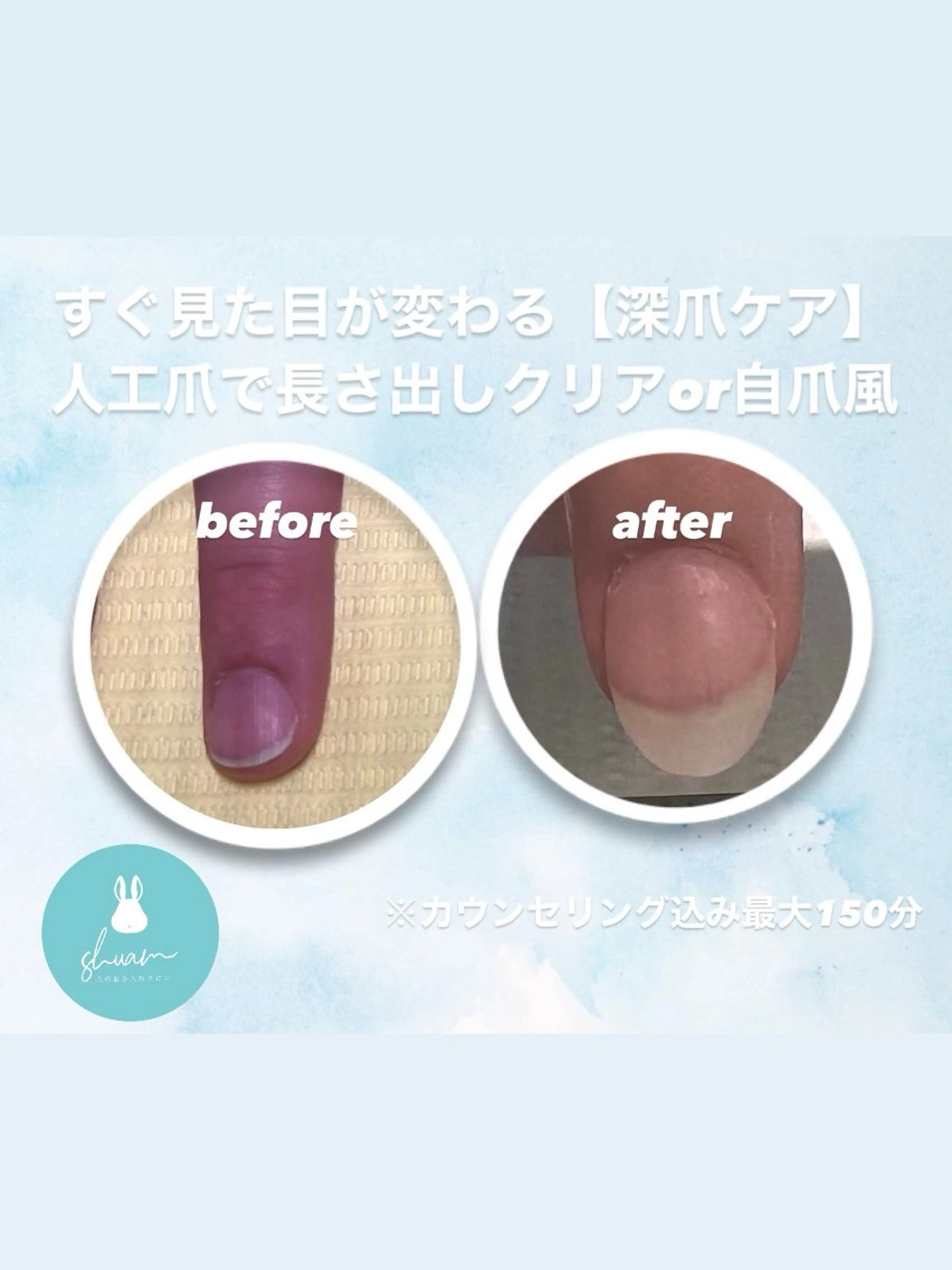 メンズ ネイル ハンドネイル 爪ケア/深爪 自爪育成 🐰えむのネイルデザイン