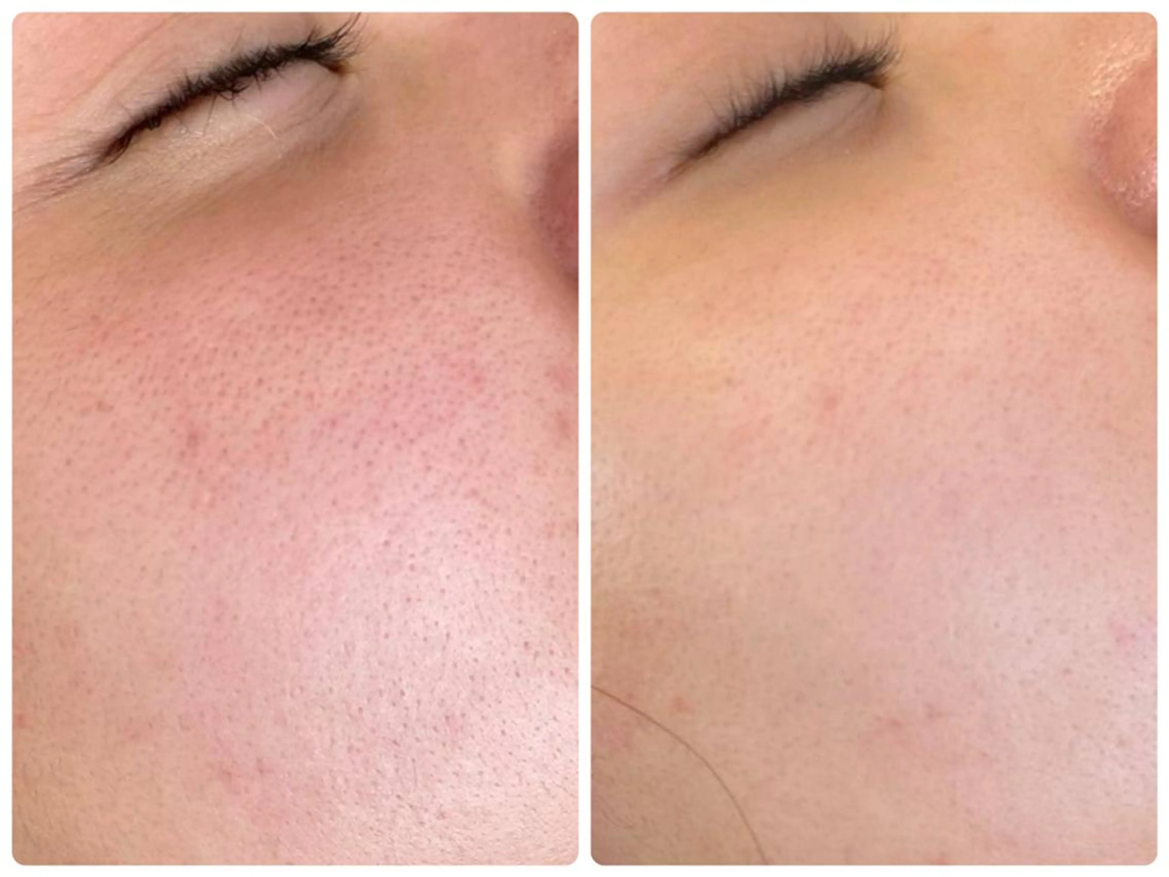 エステ 小林 理恵のエステ・リラクイメージ