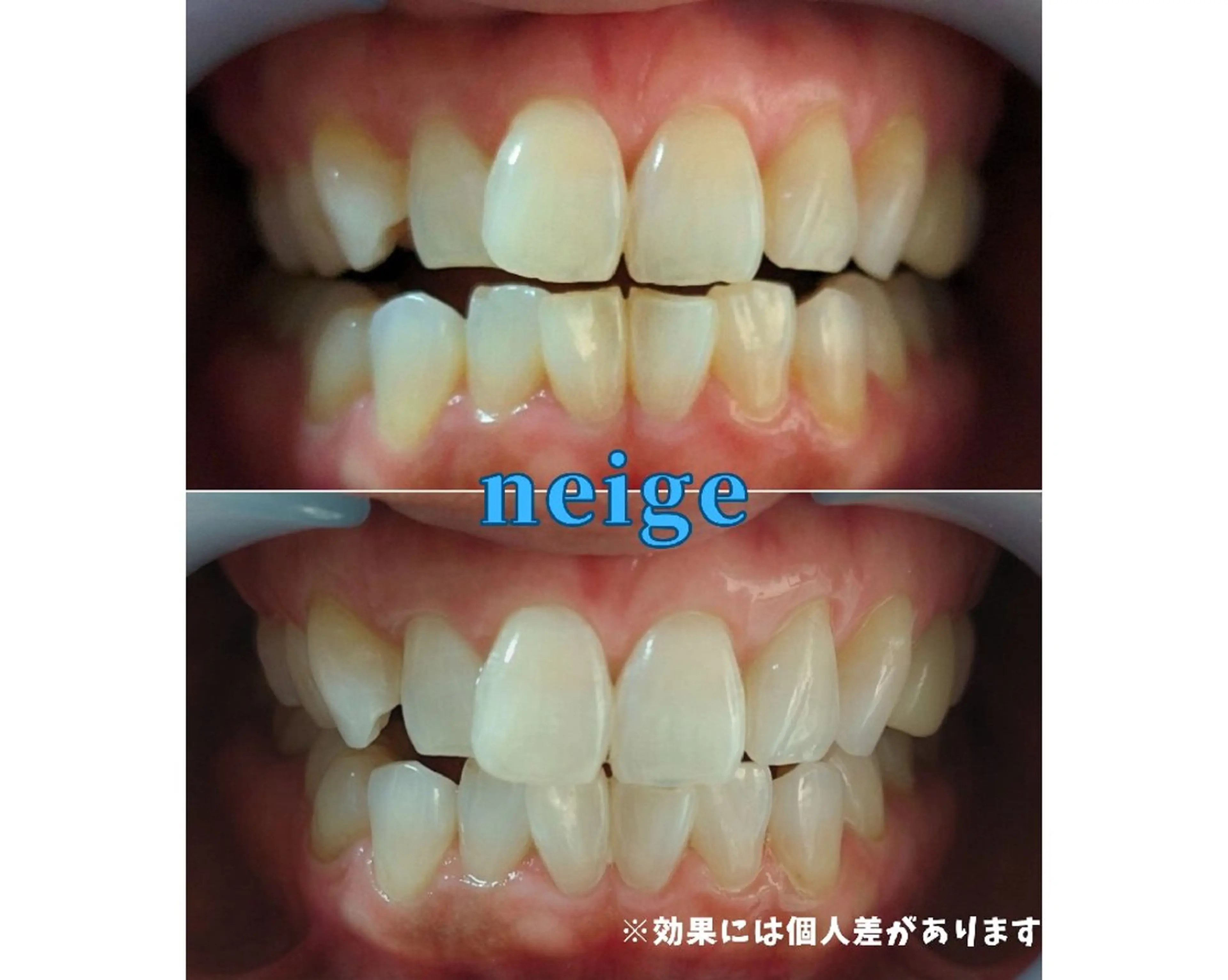 その他 ホワイトニングサロン ネージュ(女性専用)のその他イメージ