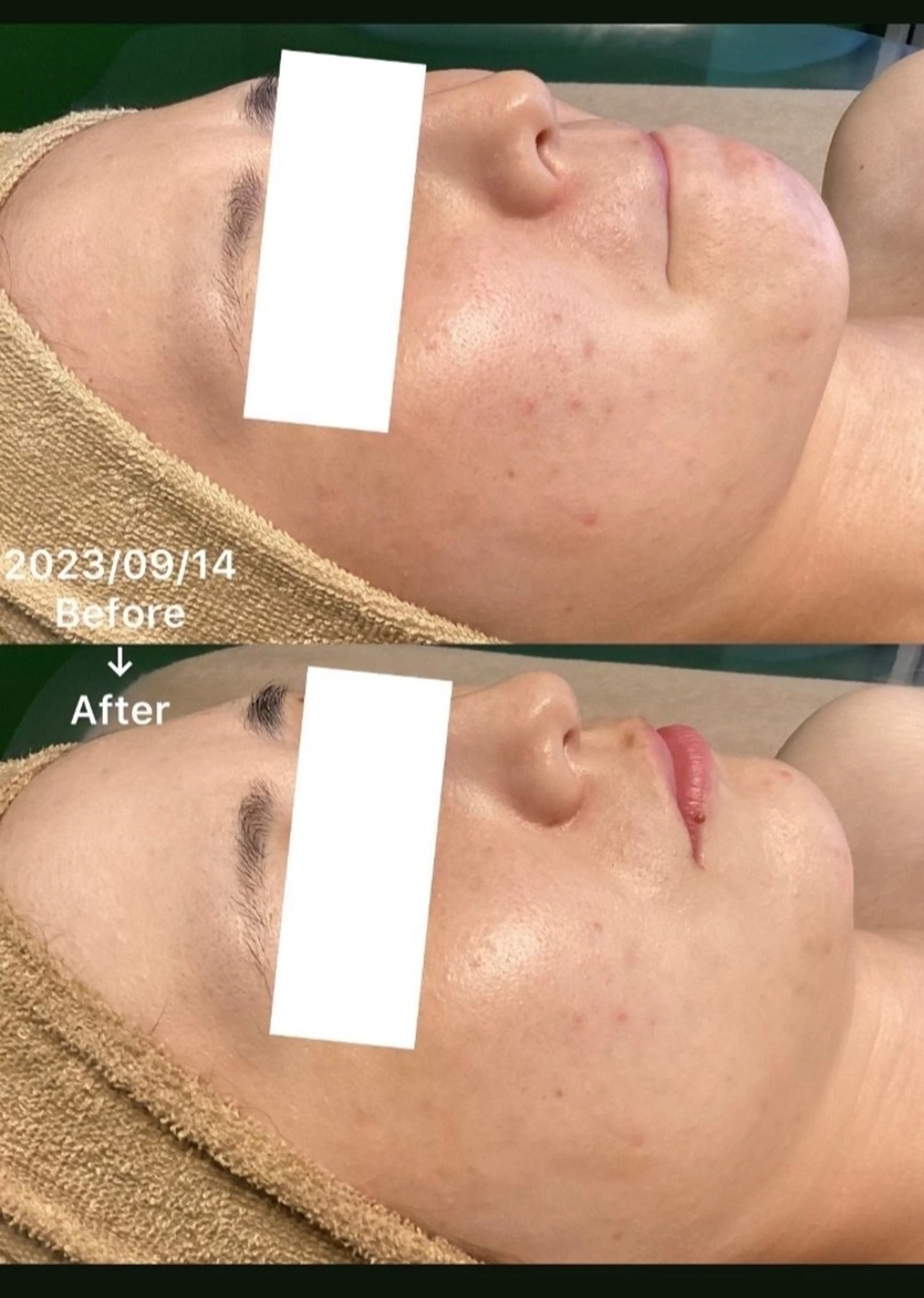 エステ オイル＆フェイシャル 【月のあかり🌙】のエステ・リラクイメージ