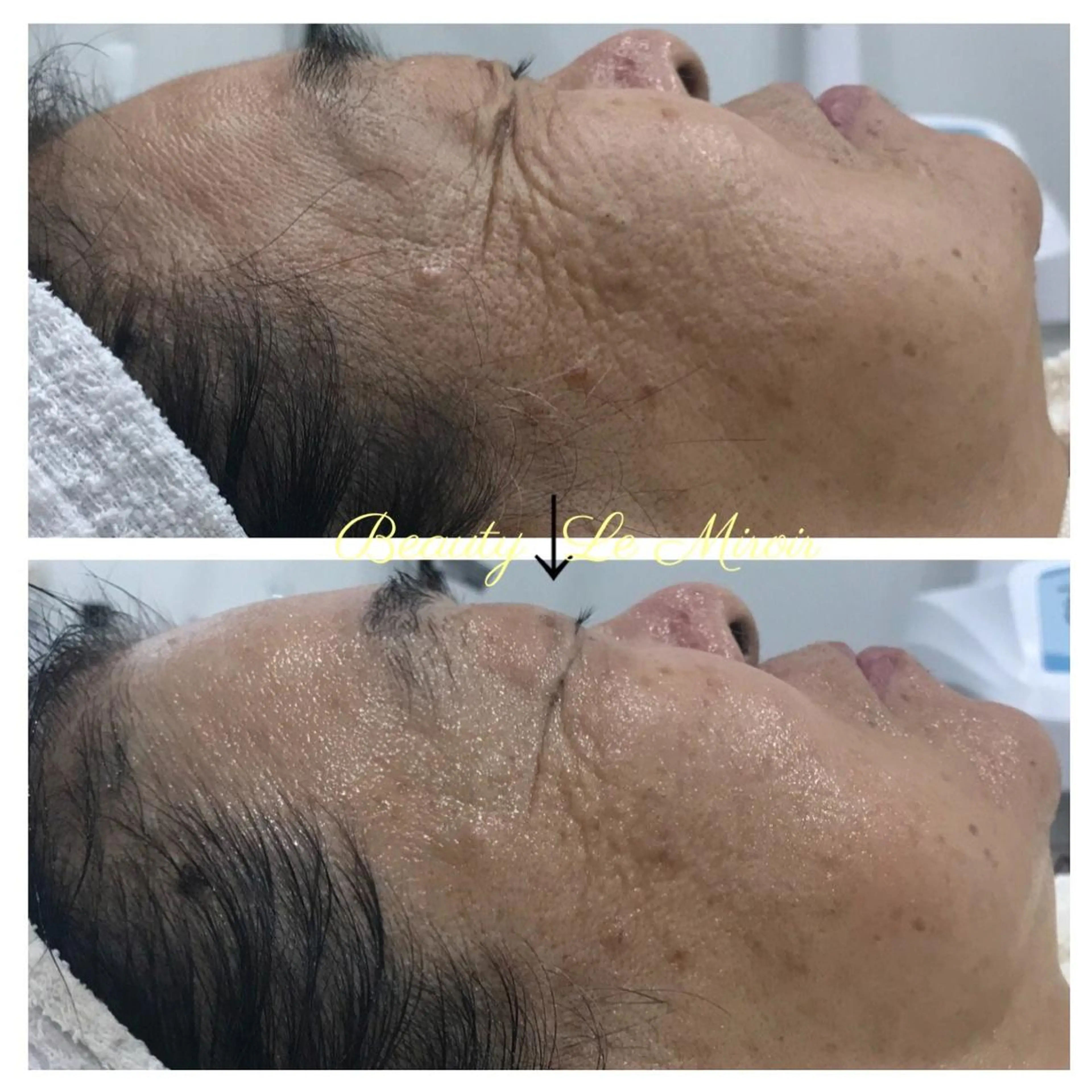 ビューティー ミロワールのエステ・リラクイメージ