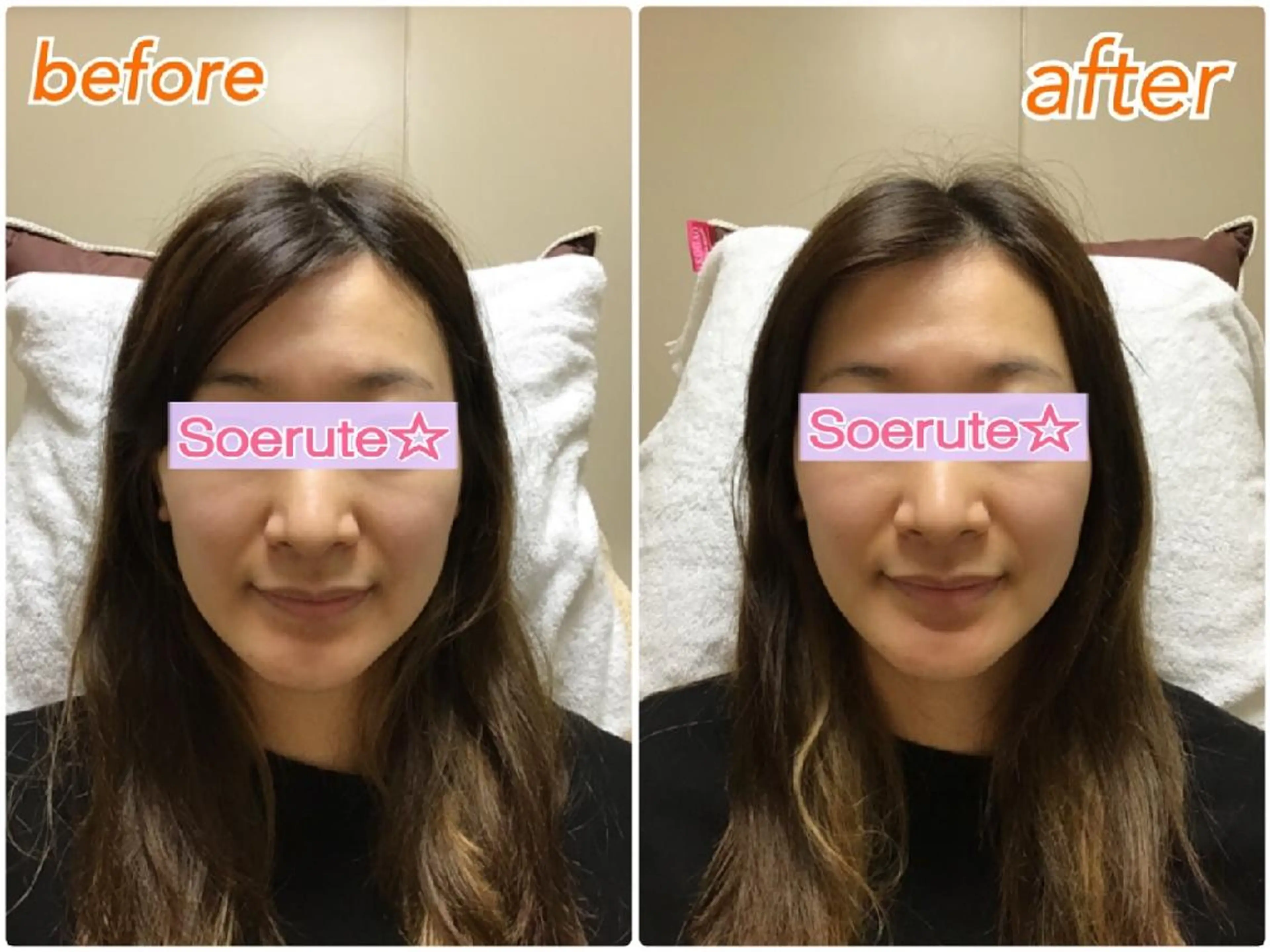 エステ リラク Soerute☆ ソエルテ 井上みえのエステ・リラクイメージ