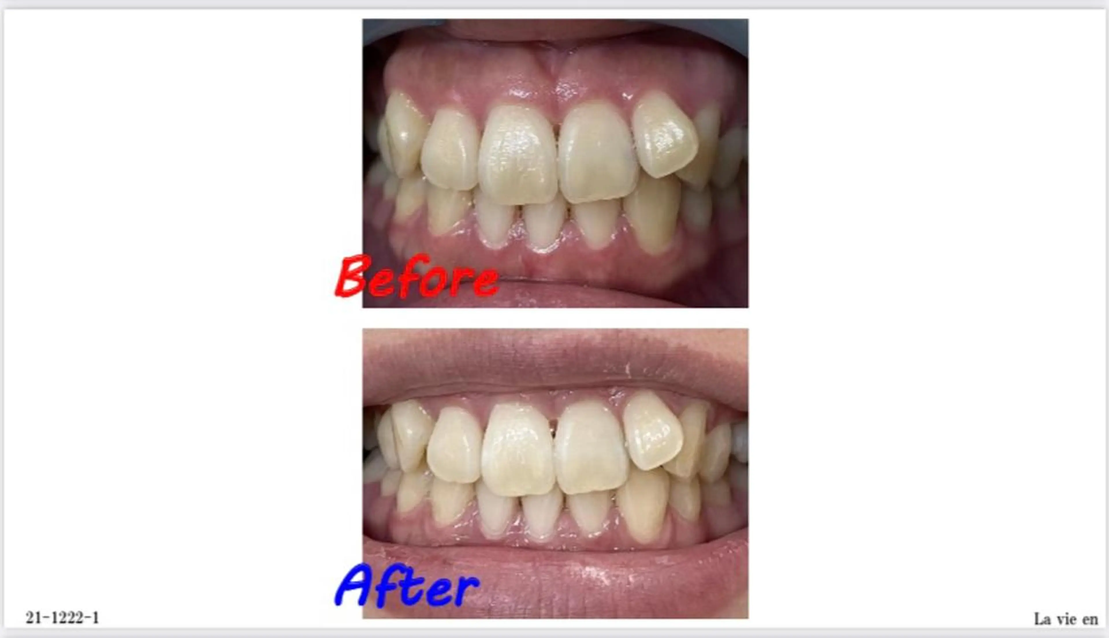 その他 ホワイトニングサロン La vie enのその他イメージ