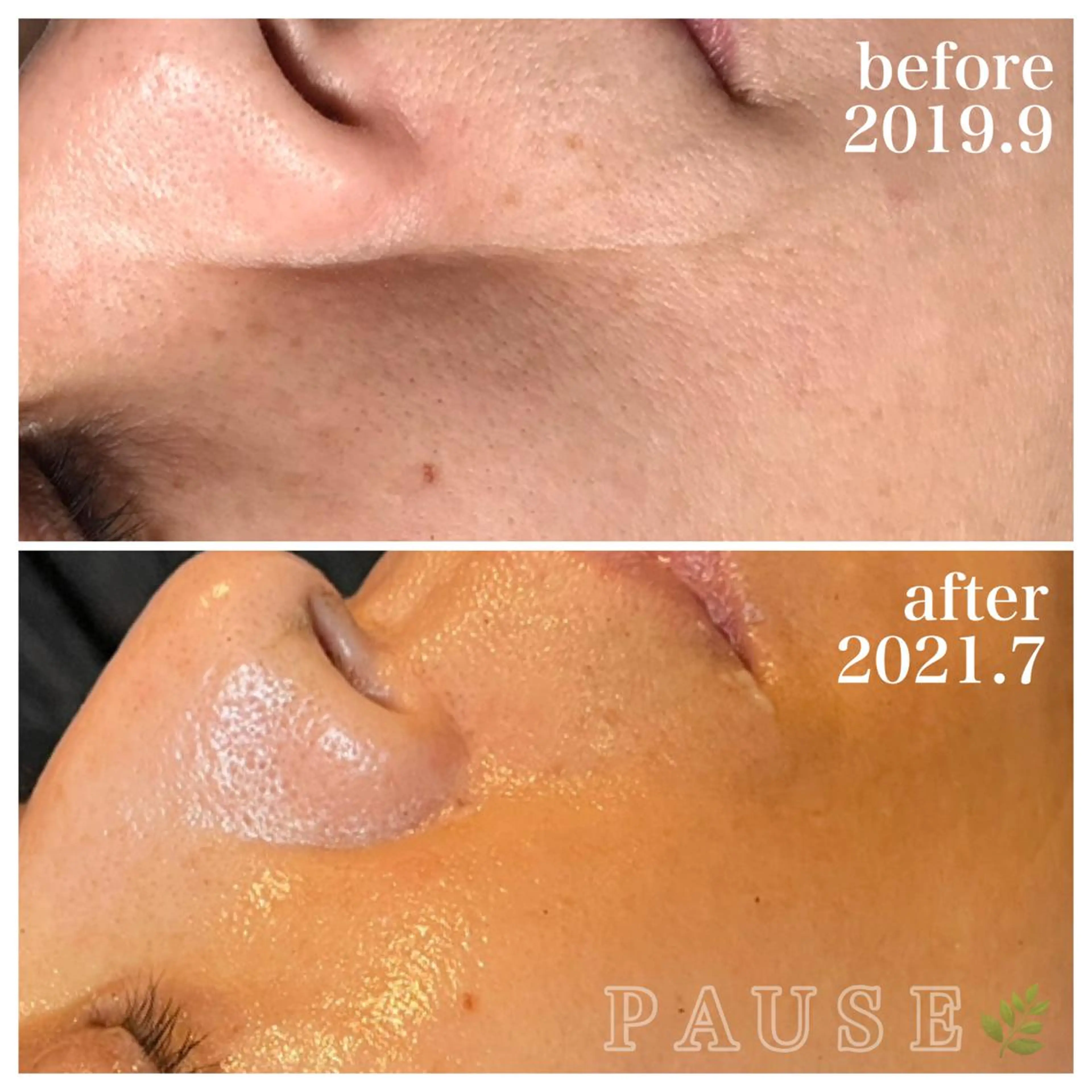 エステ 浜野 恵美のエステ・リラクイメージ