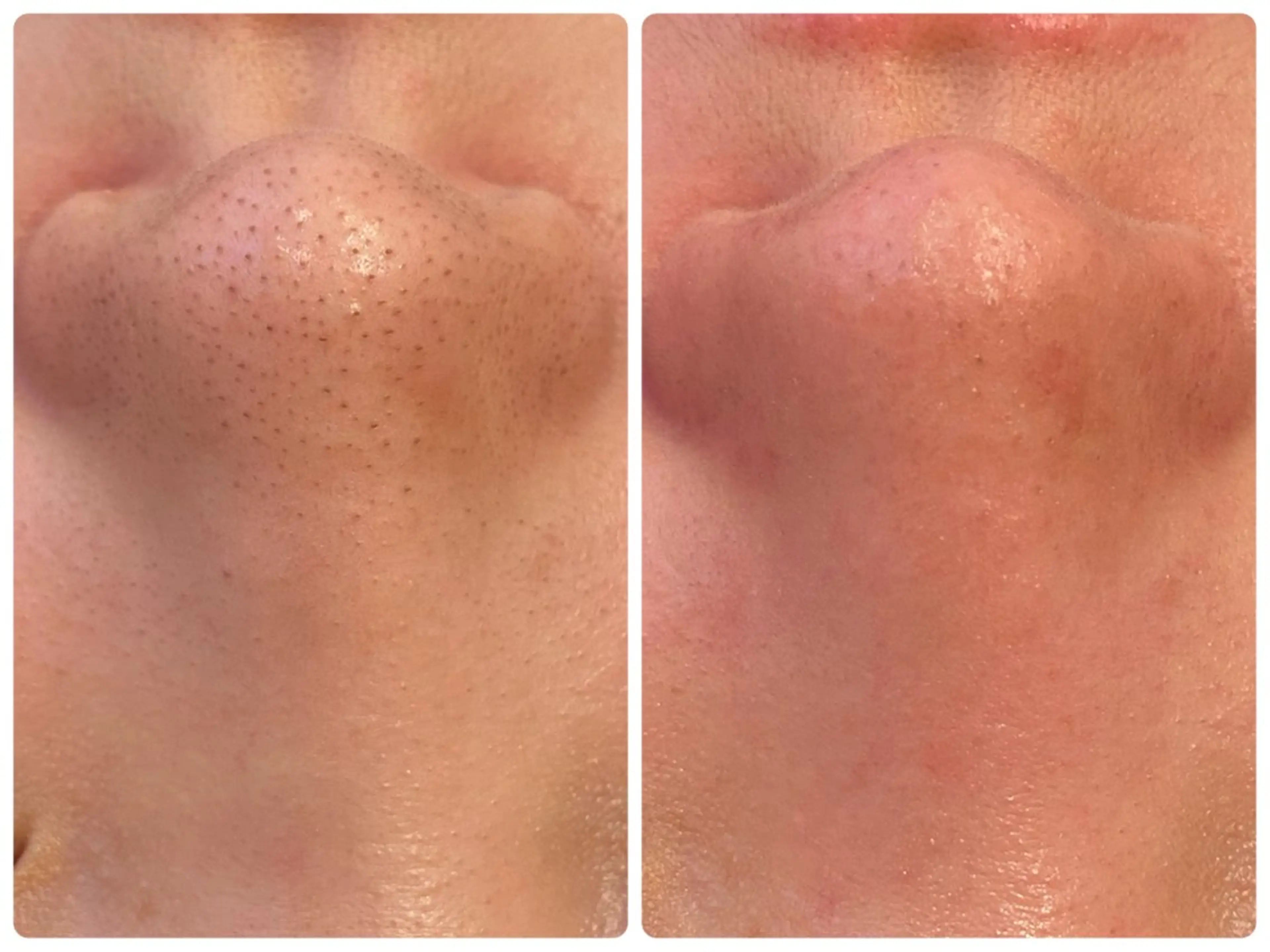 Hisui 小出のエステ・リラクイメージ