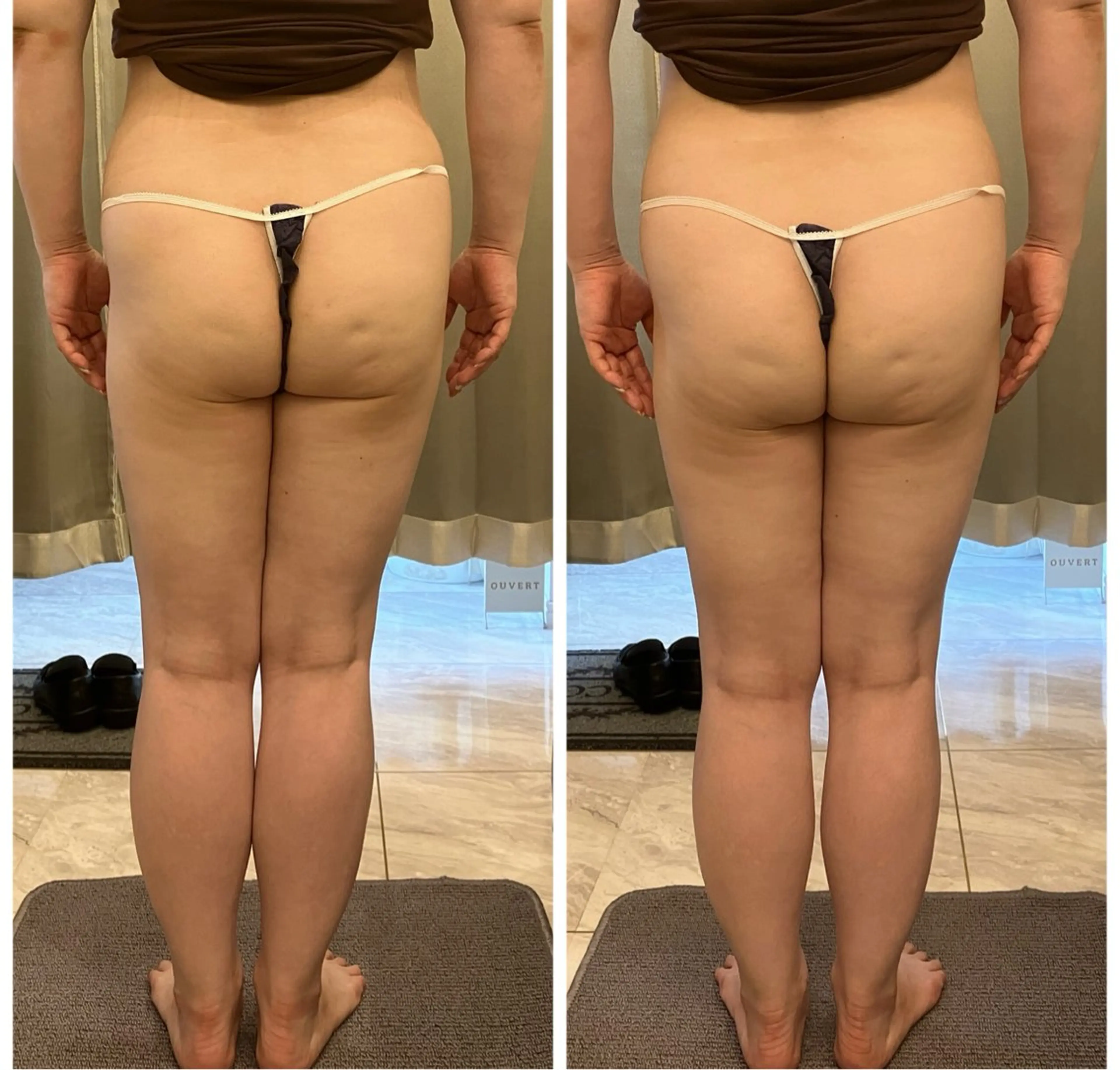 エステ リラク infinity所属・Infinity KAYOのその他イメージ