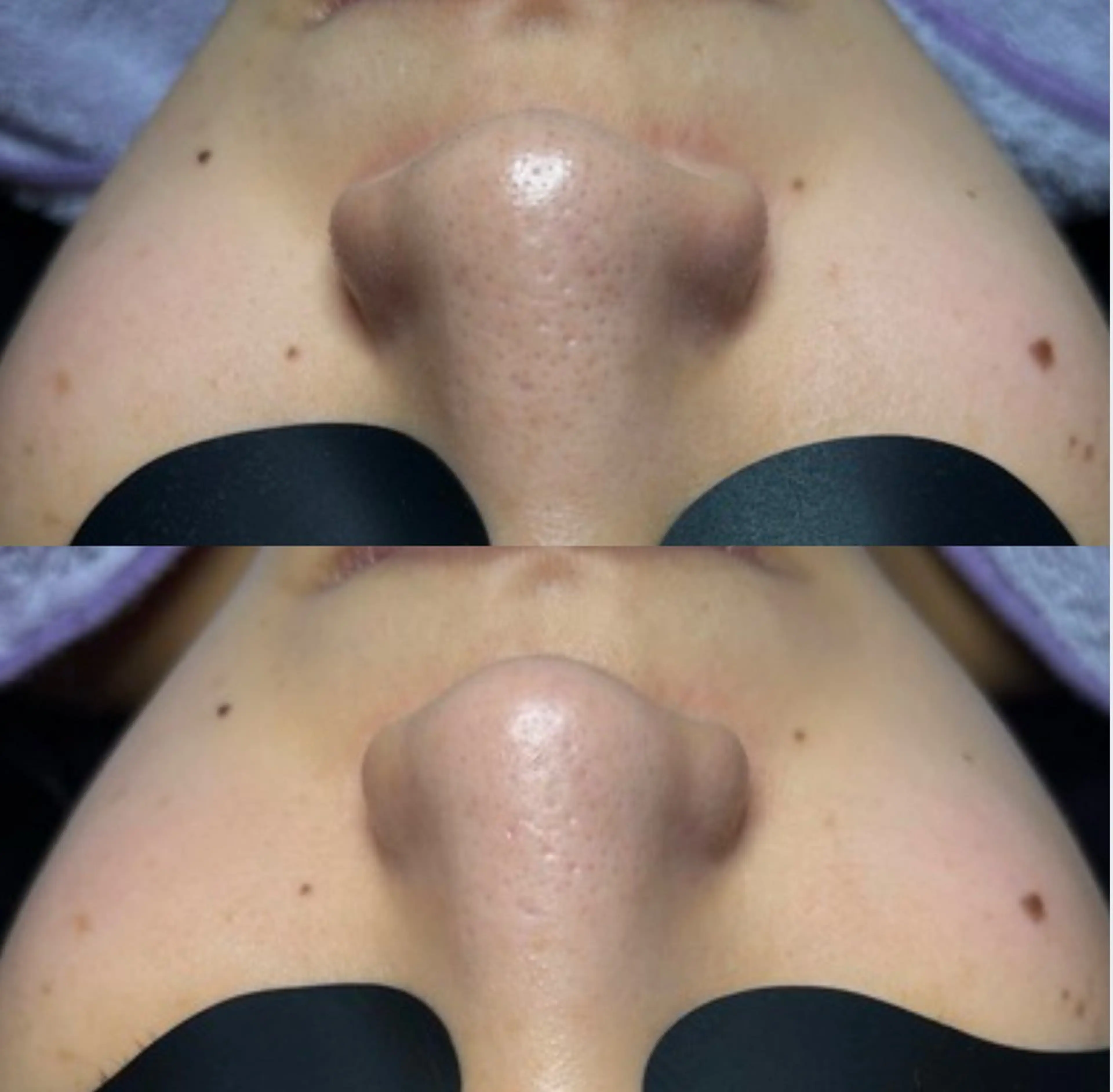 エステ beauty salonN.11のエステ・リラクイメージ