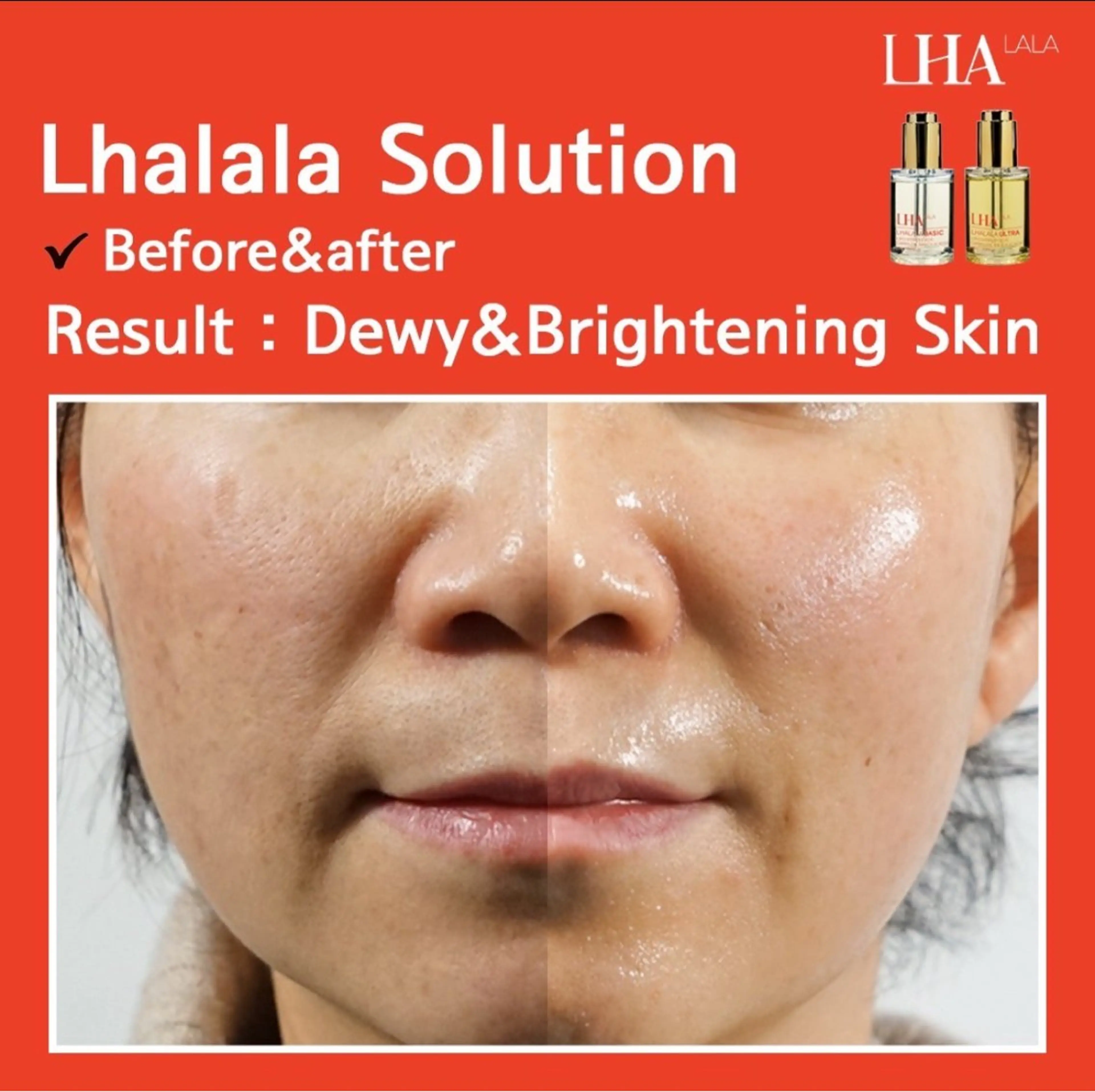 最新✨韓国🇰🇷で大人気💆‍♀️ララピール🖌️💕の写真