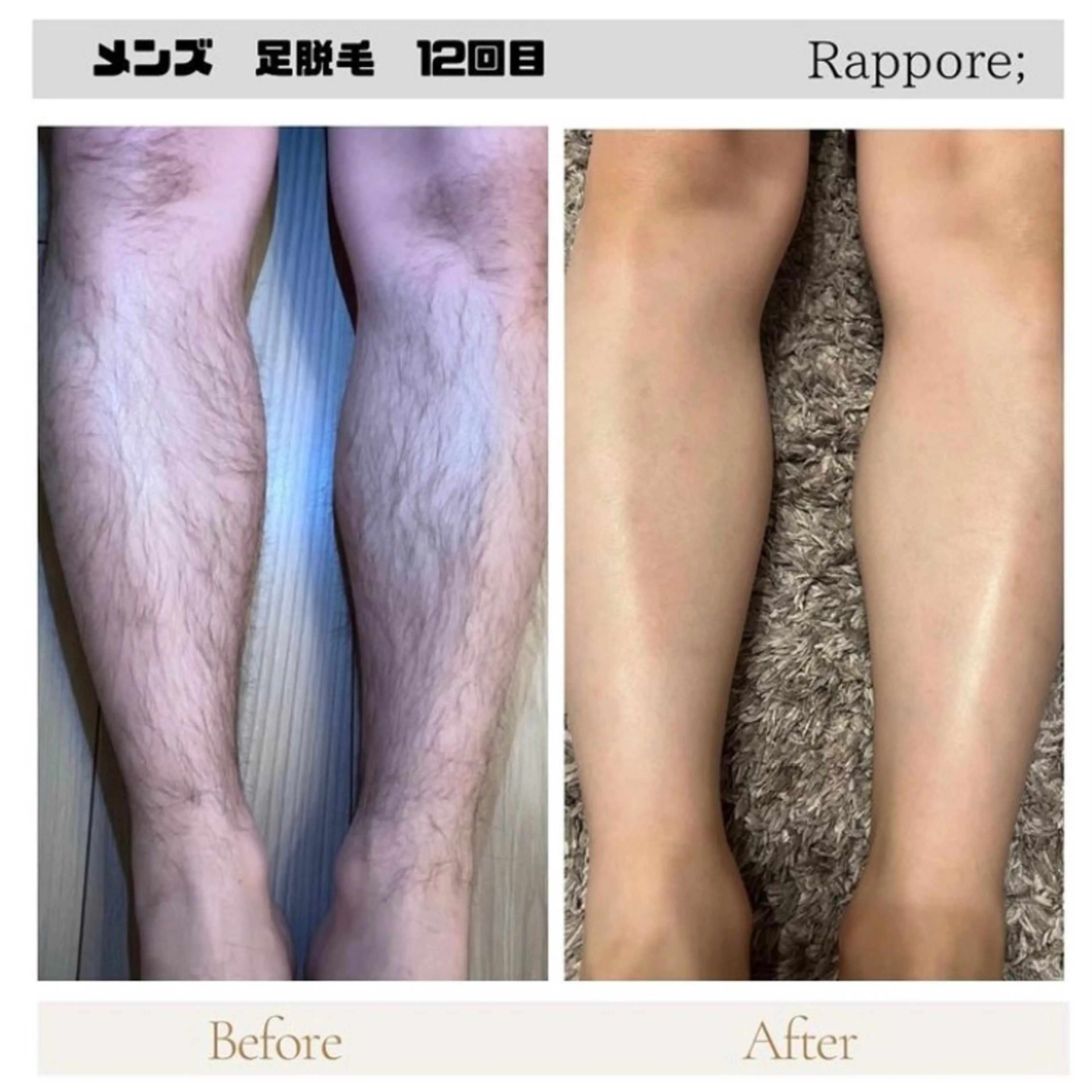 メンズ 脱毛＆フェイシャル/ Rappore;増田のエステ・リラクイメージ