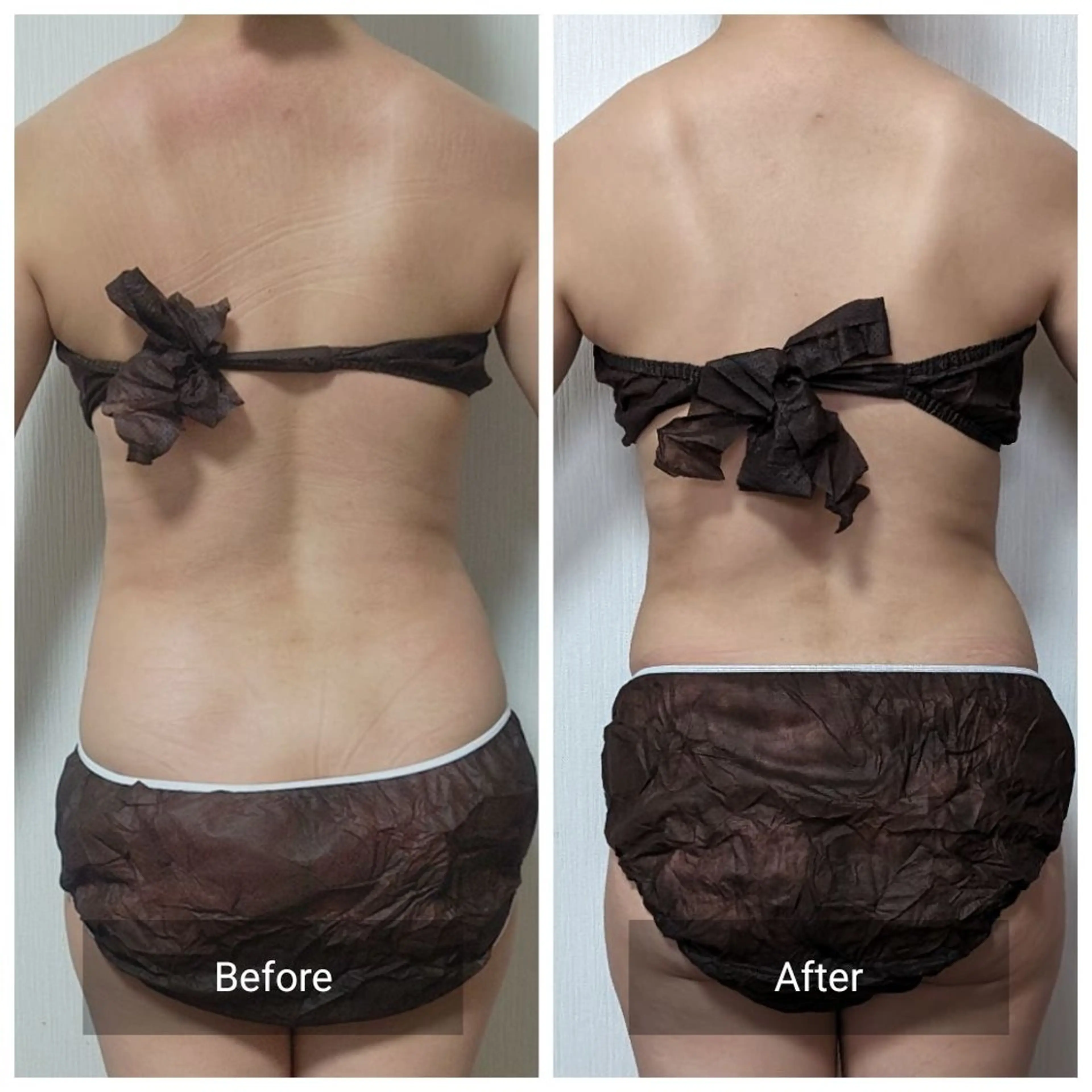 下腹部撃退！ほっそりくびれお腹集中の写真