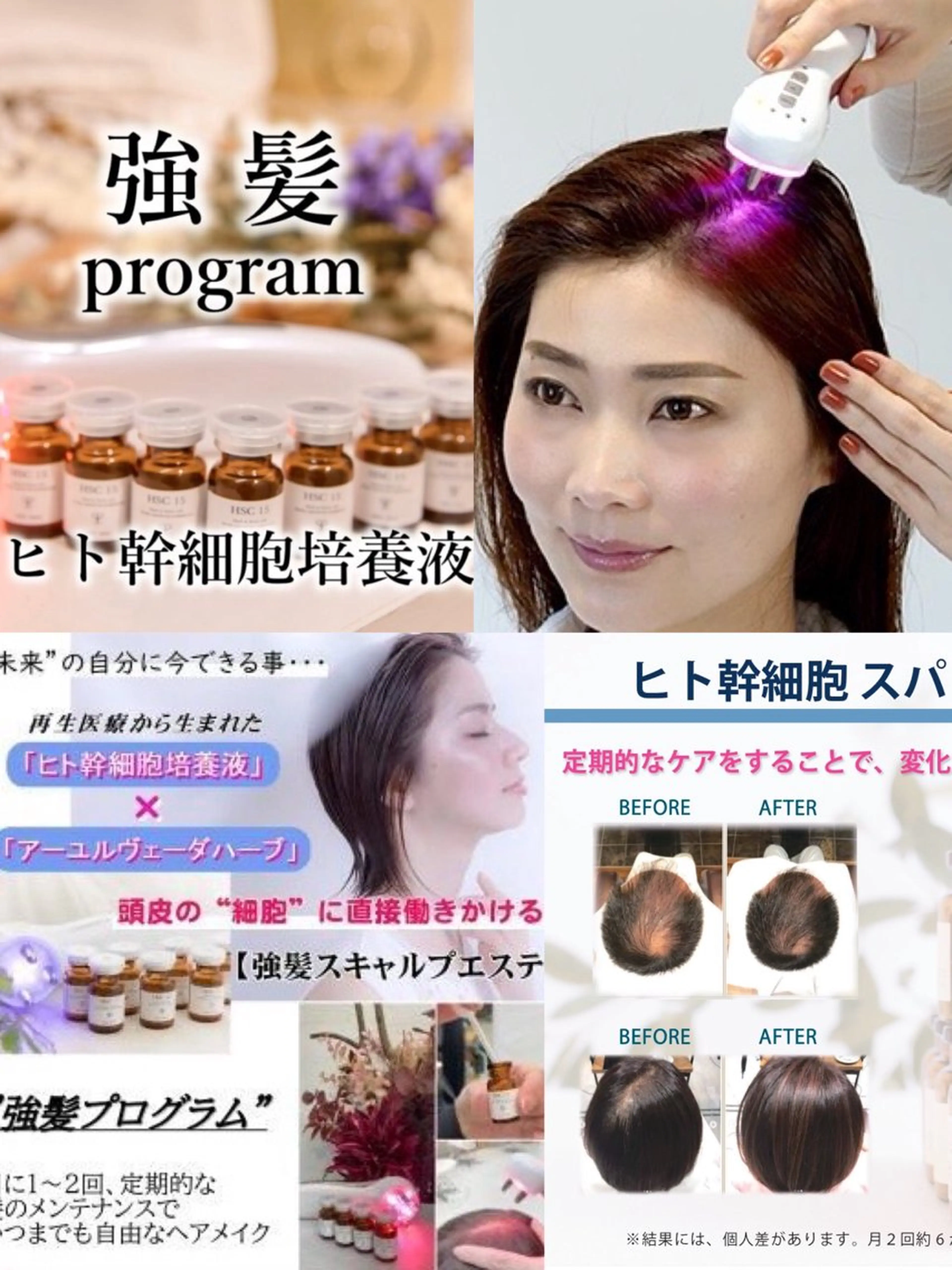 【髪のボリュームUP、育毛促進&ハリコシ】ヒト幹細胞の強髪プログラム 20の写真