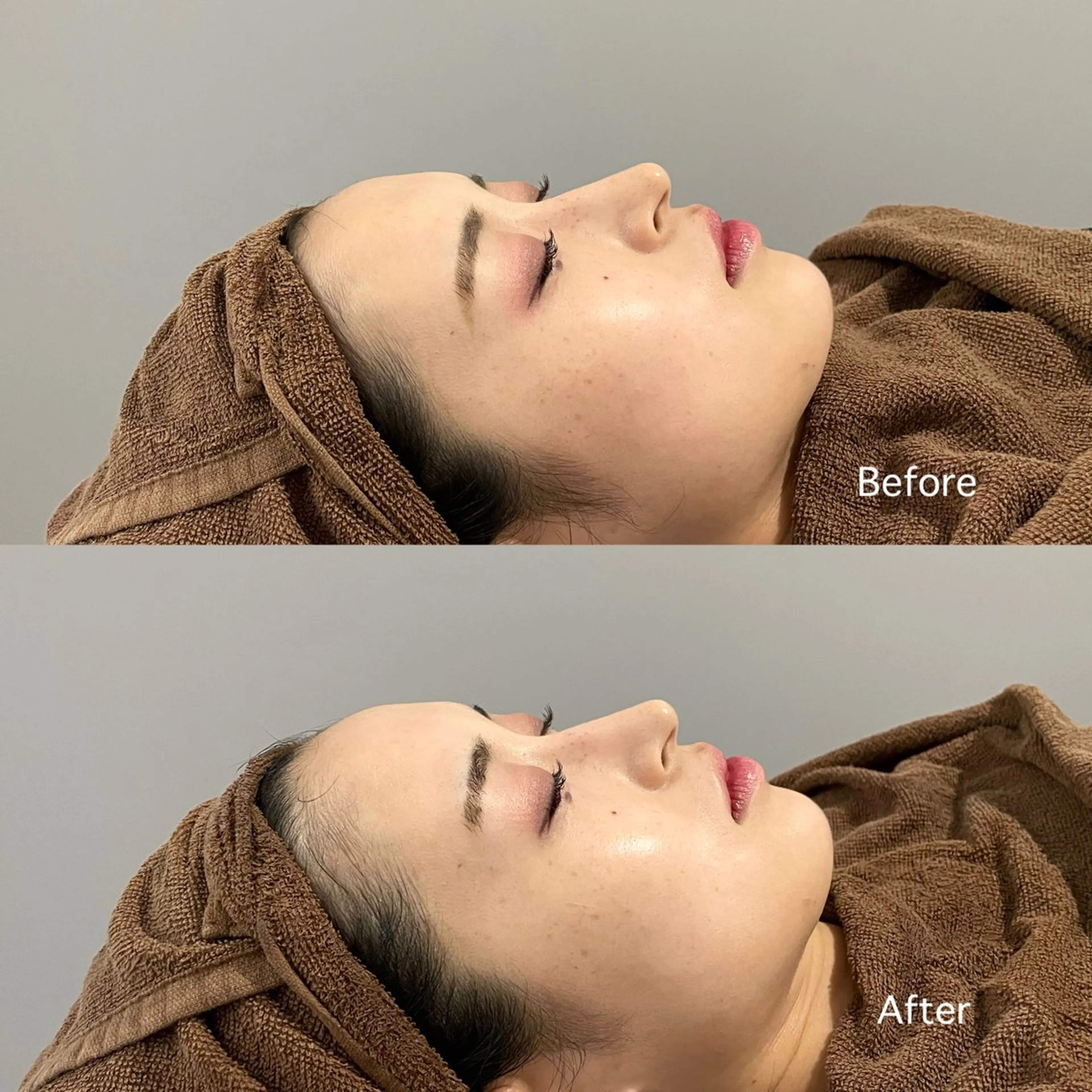 🫧大人気マーメイド水素トリートメント×毛穴洗浄🫧肌水分量UPで艶々水光肌に🧜♀️✨の写真