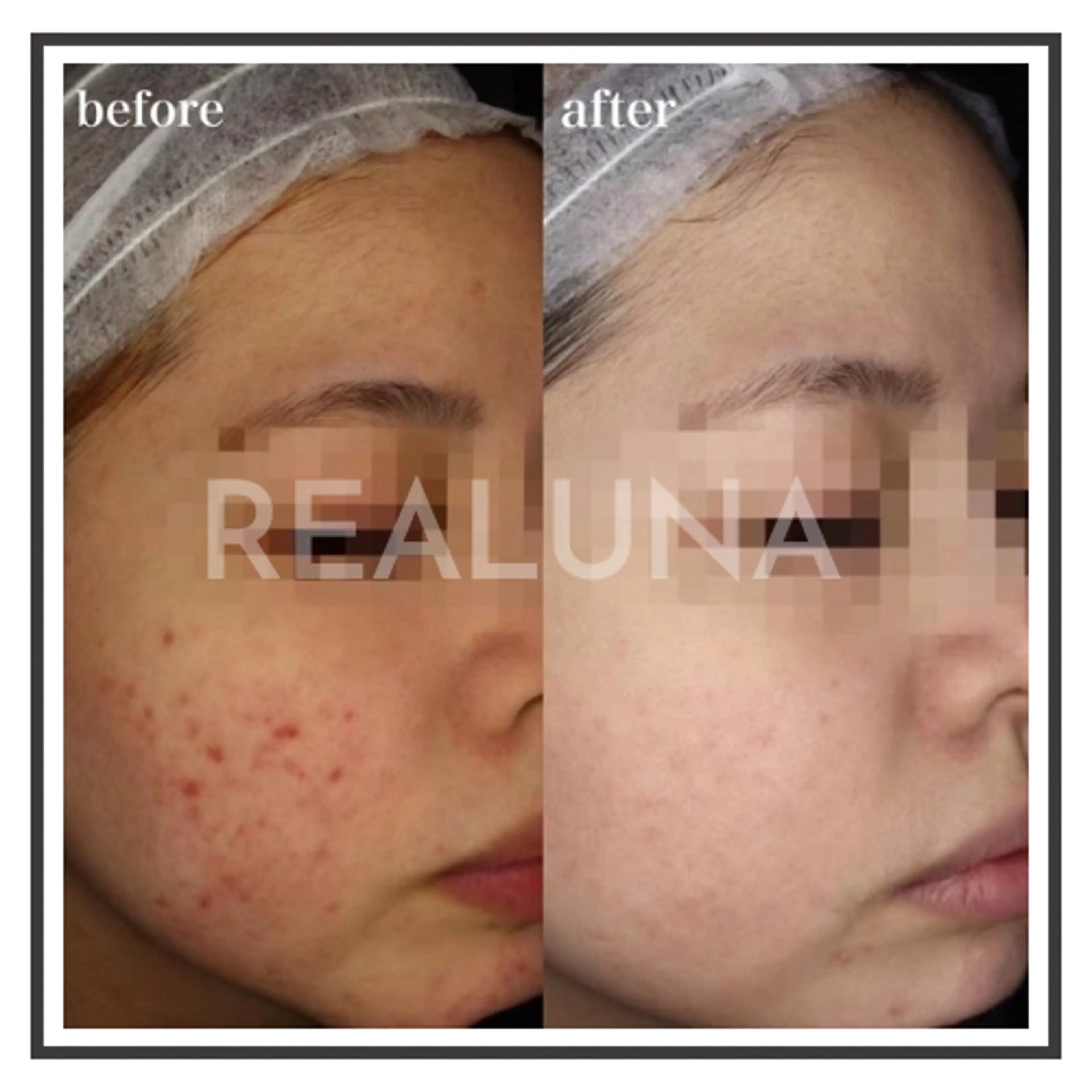 エステ REALUNA CHIHIROのエステ・リラクイメージ