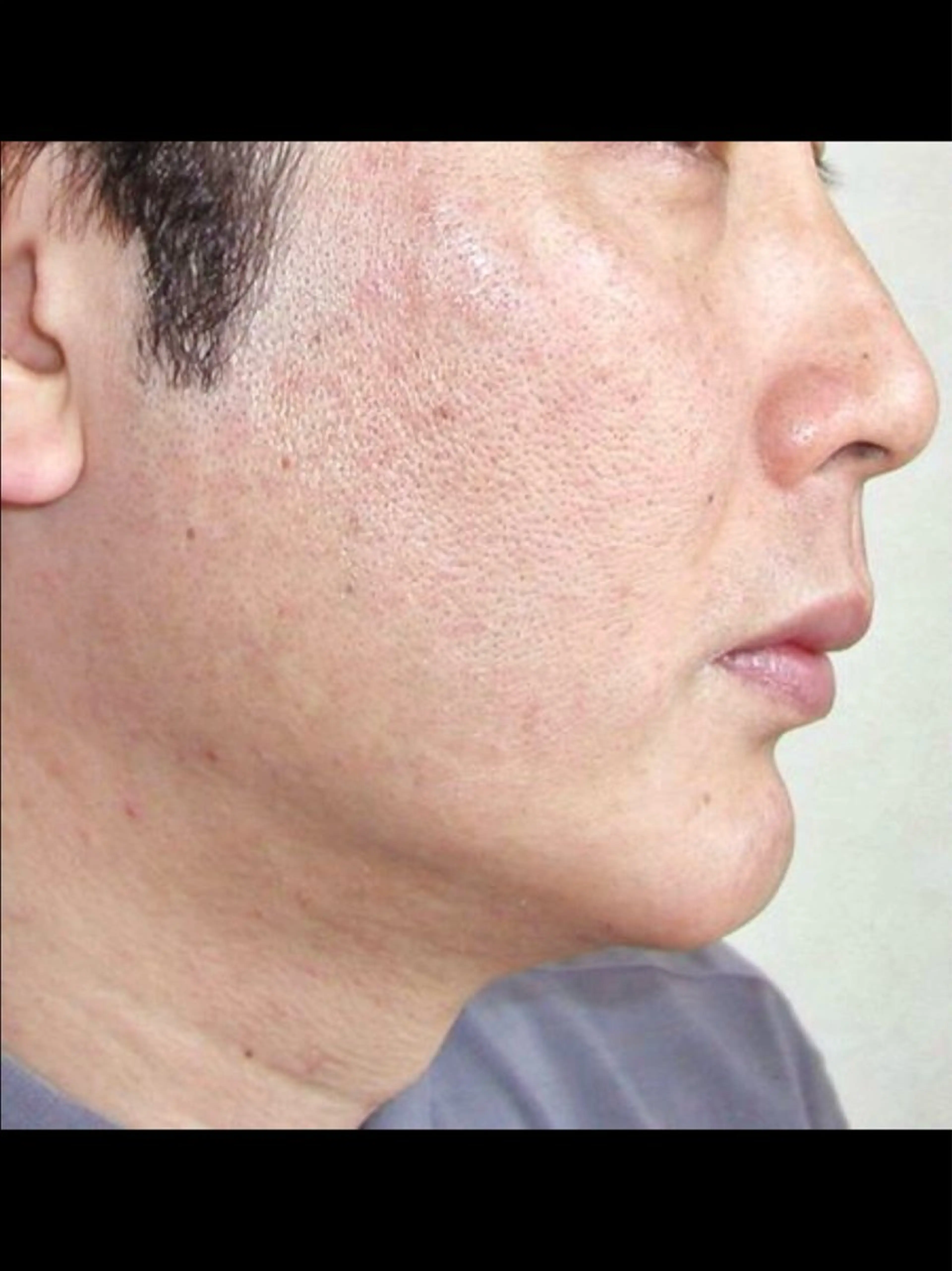 メンズ 脱毛 ☀️Akala☀️ メンズ脱毛のエステ・リラクイメージ