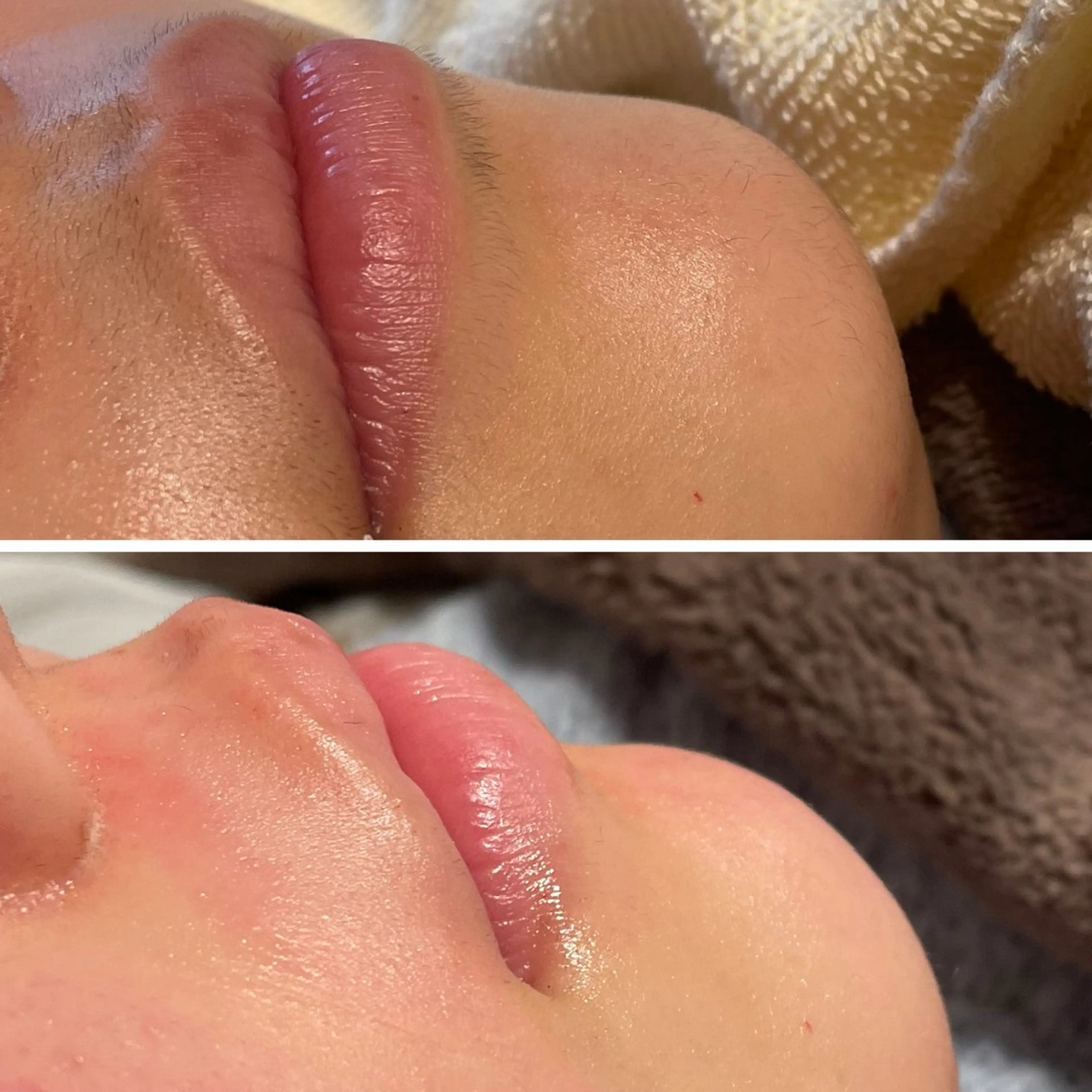 脱毛 Erika komorebi_のエステ・リラクイメージ