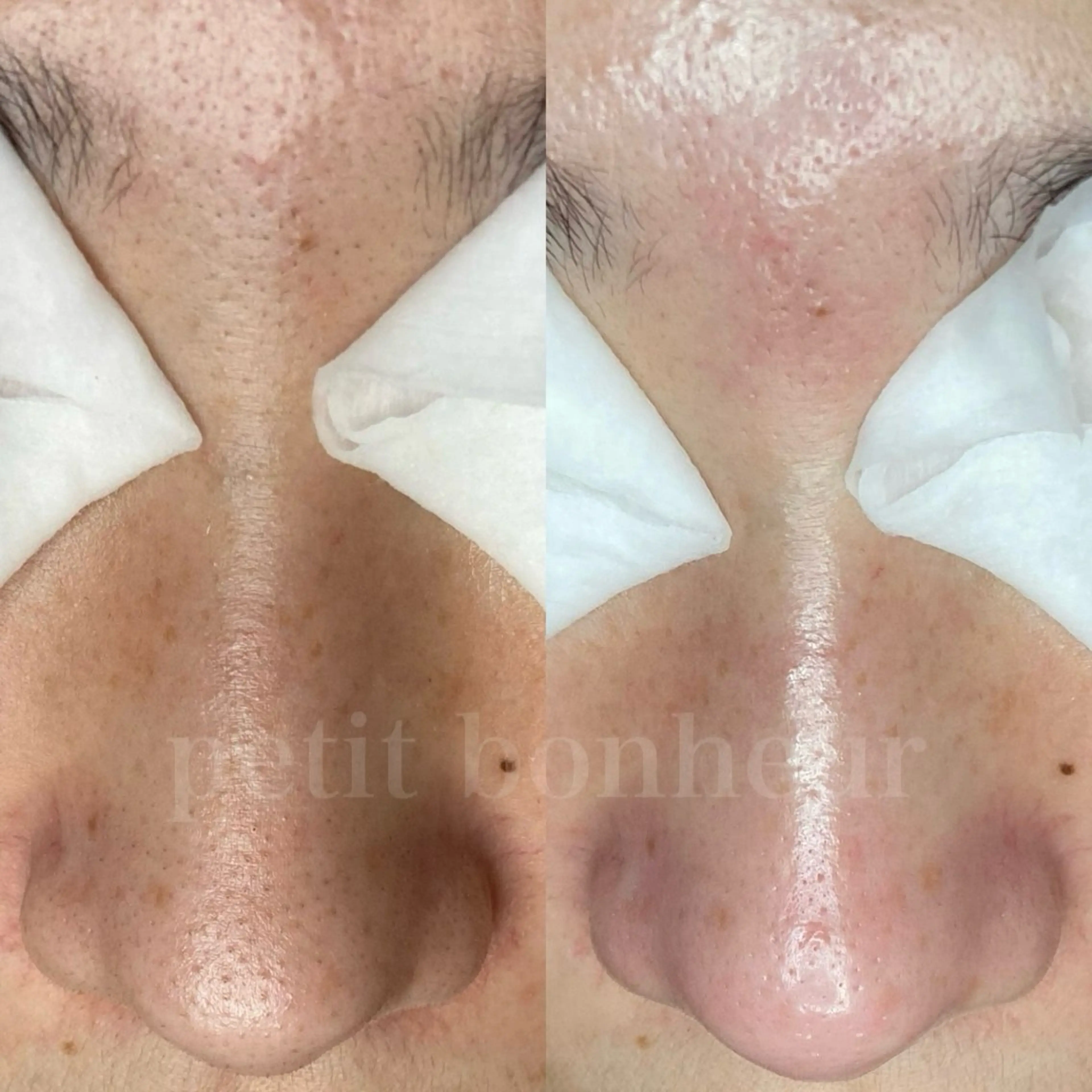 エステ 槙谷 あさみのエステ・リラクイメージ