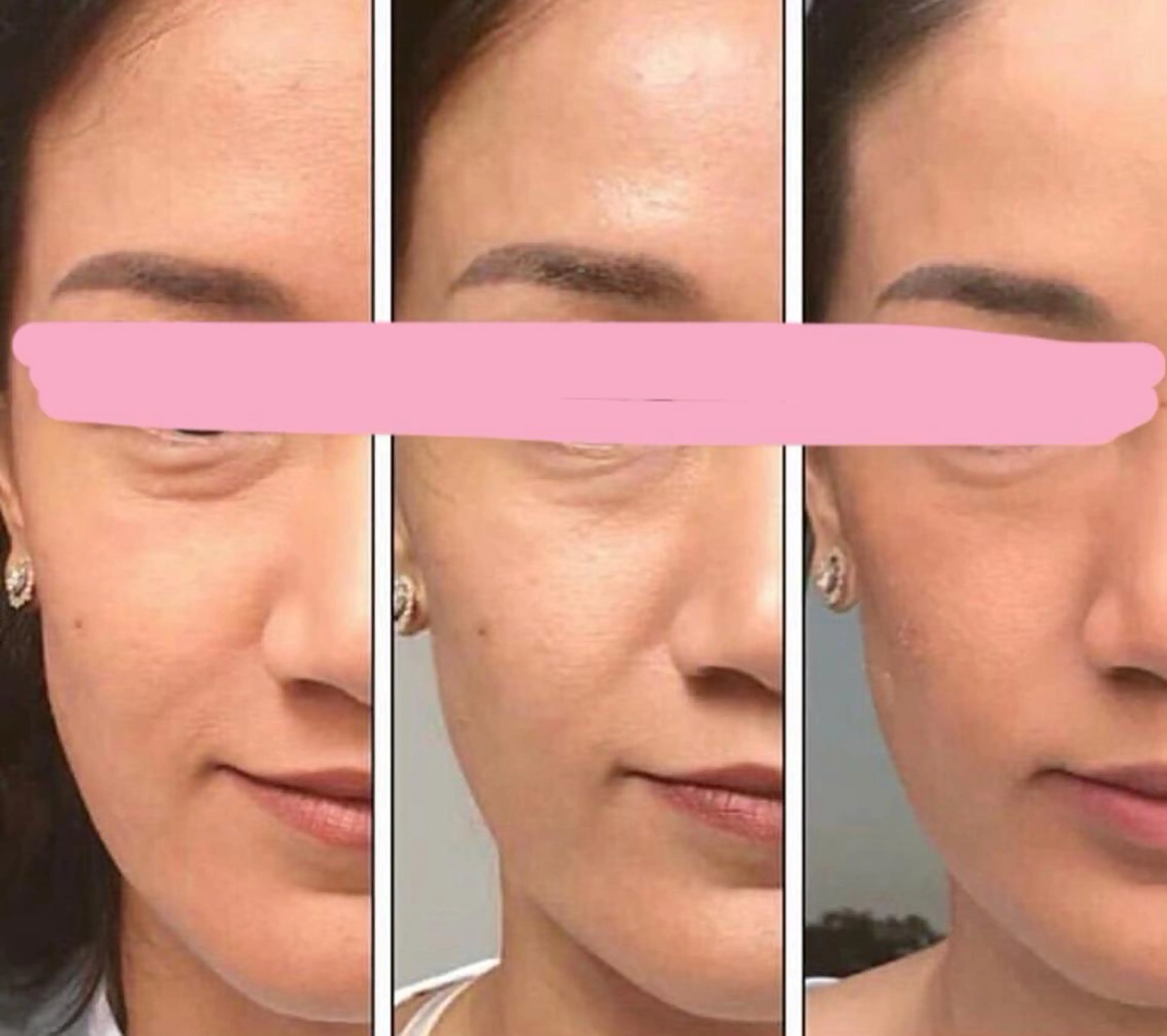 小顔美人リフトアップコース 50分 （希望者はメイクまで可能）の写真