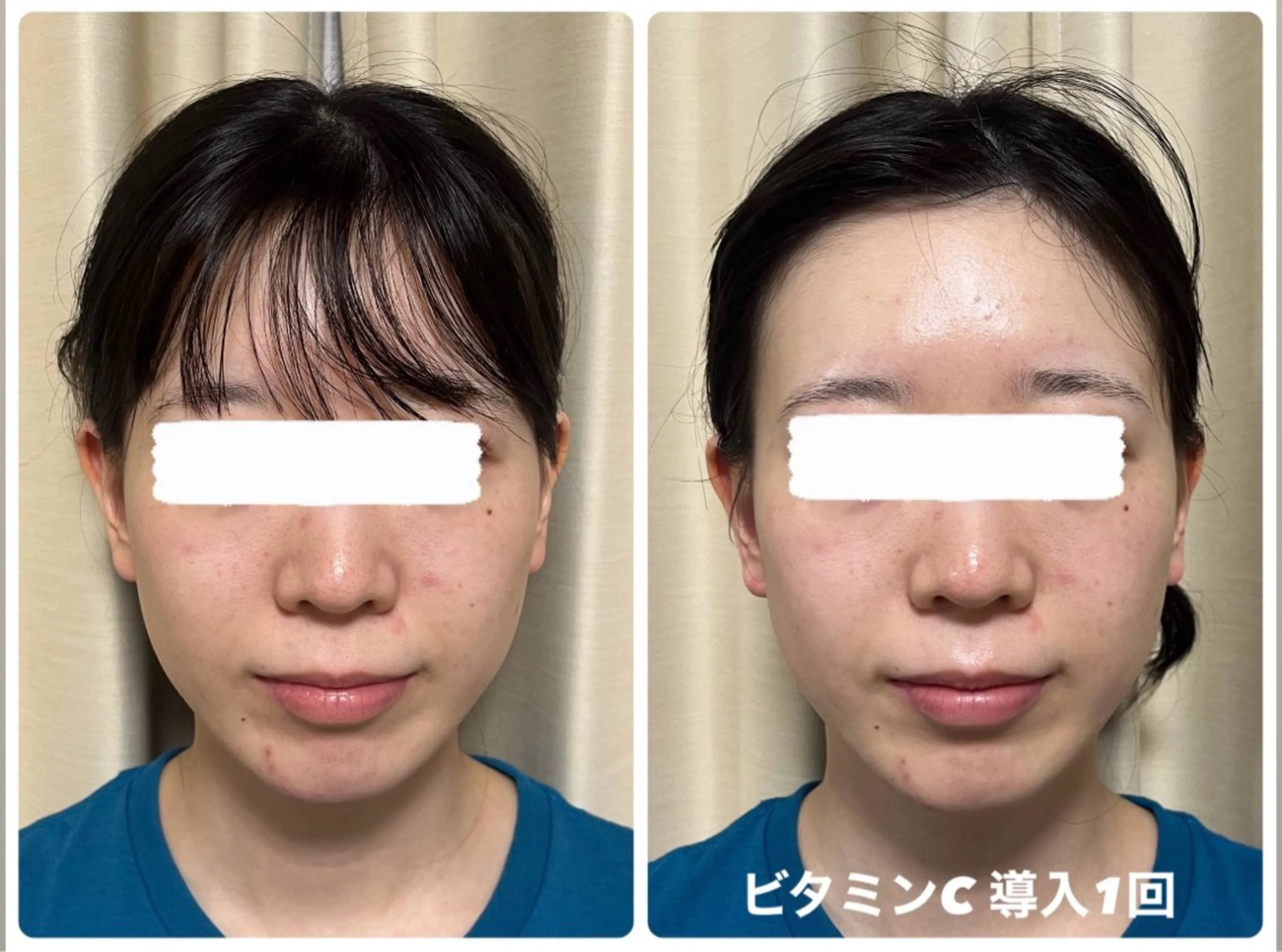 エステ 豊田 明里のエステ・リラクイメージ