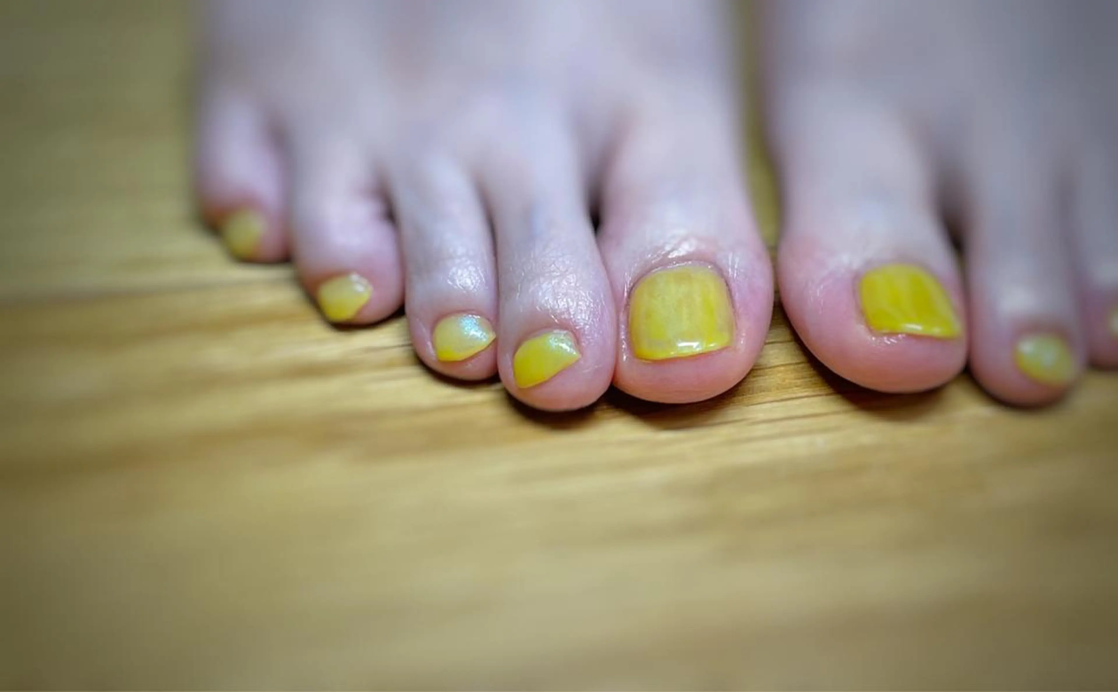 ネイル amo_nail 岡山市南区自宅ネイルのネイルデザイン