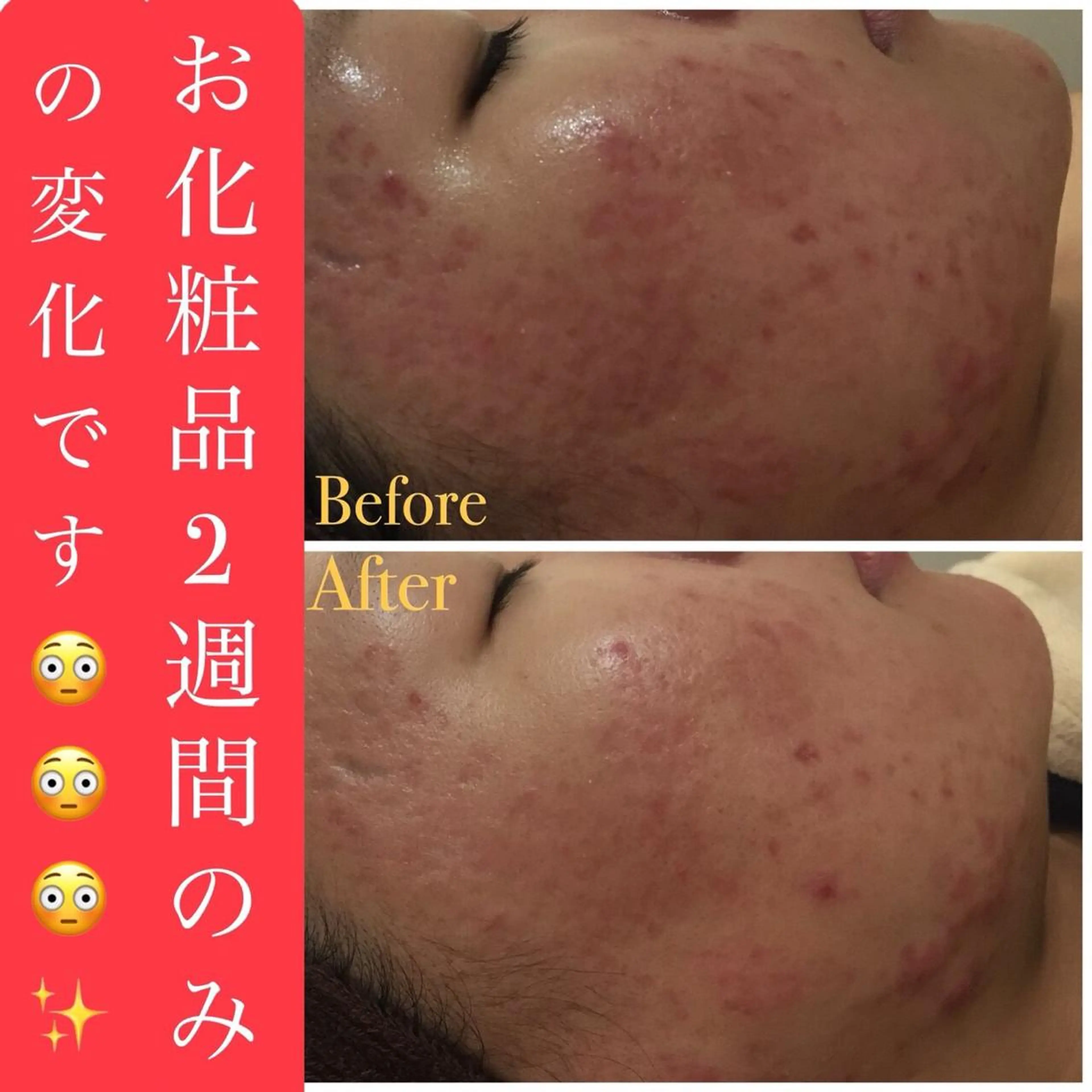 ショート カラー パーマ ヘアアレンジ メンズ キッズ ネイル マツエク・マツパ エステ リラク ニキビ・肌質改善専門 ♡人生が変わるサロンのエステ・リラクイメージ