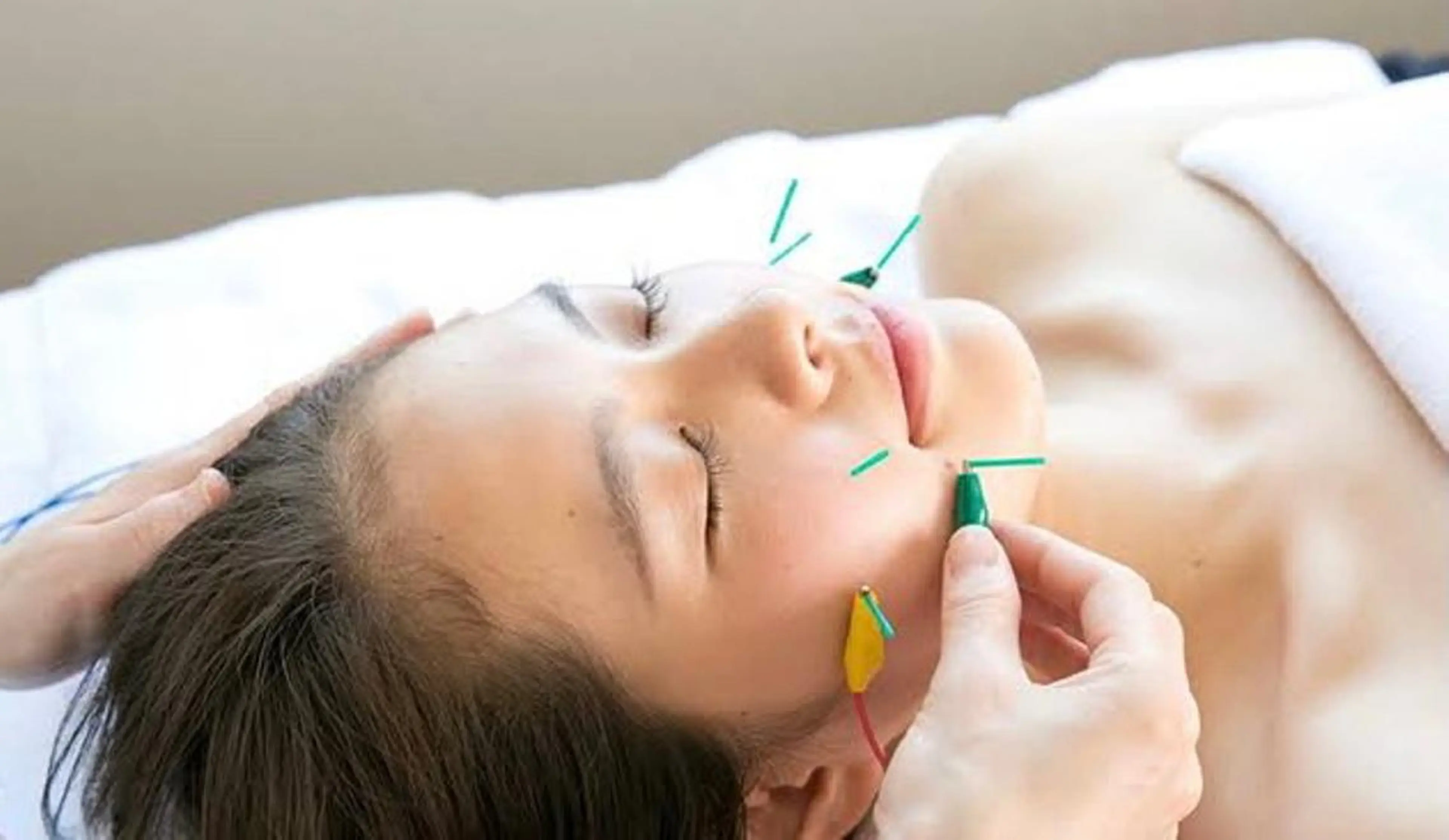 【フェイス特化】電流美容鍼＋ヘッドマッサージ付の写真