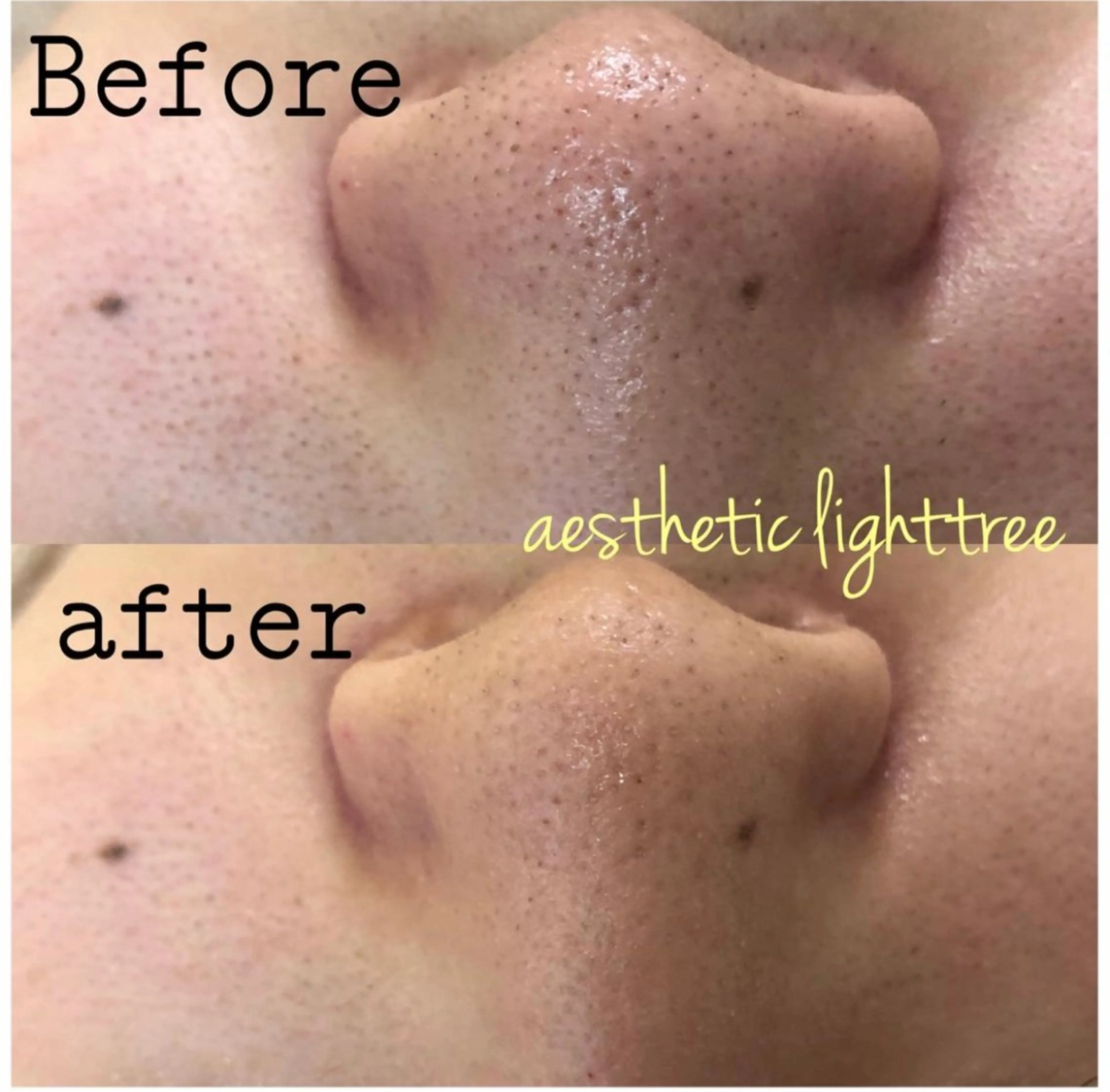 都度払い肌改善専門店 店長二上文香のエステ・リラクイメージ