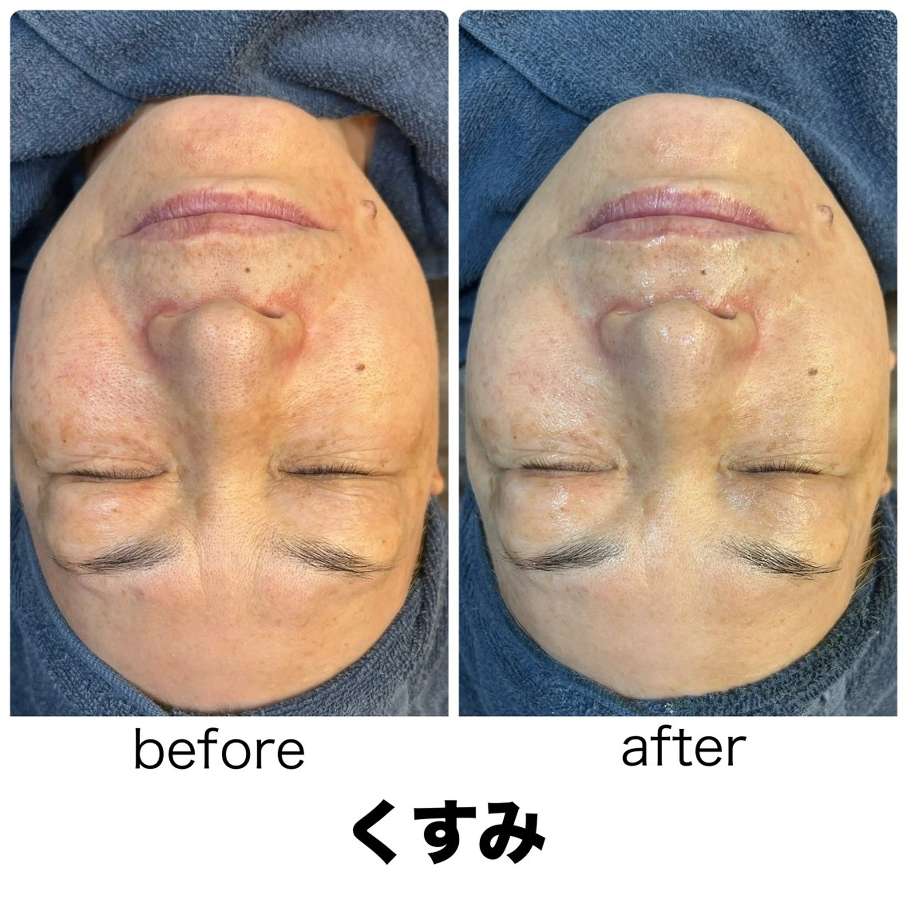 leolo武蔵浦和 肌質改善&脱毛のエステ・リラクイメージ