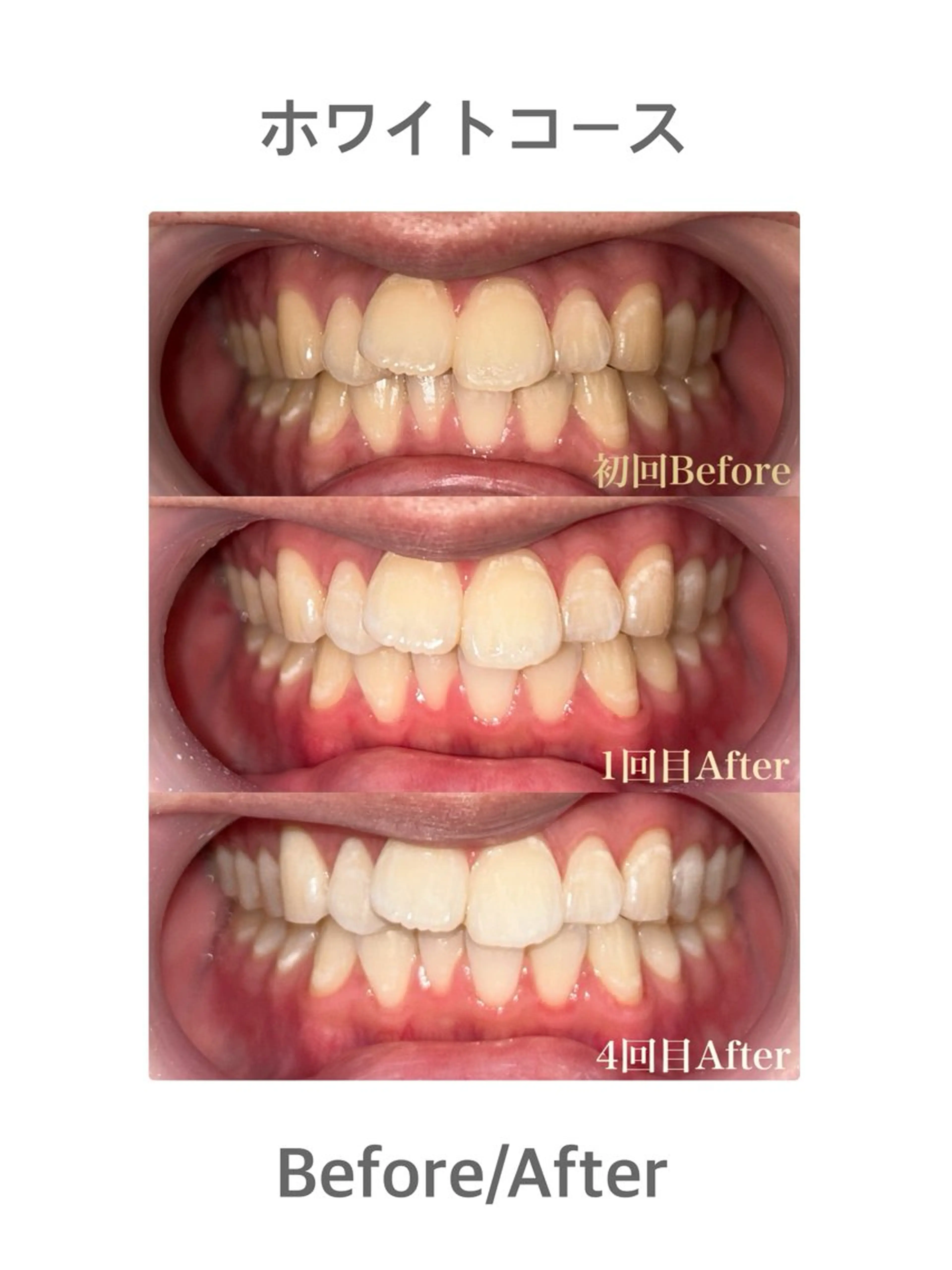 セルフホワイトニングサロンMUSE所属・セルフホワイトニング MUSE🫧焼津のその他イメージ