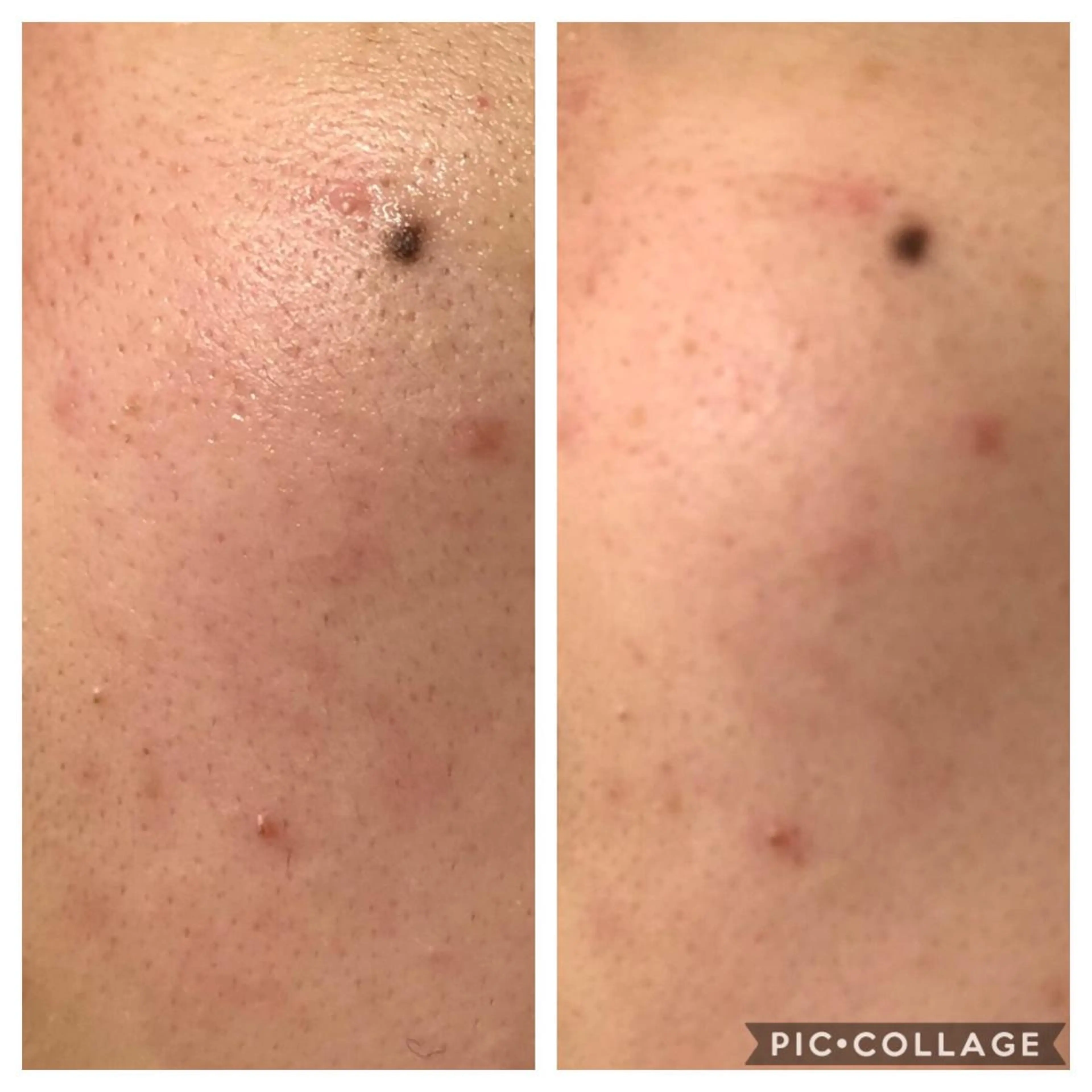 ミディアム カラー パーマ ヘアアレンジ キッズ ネイル マツエク・マツパ エステ リラク EnsorClair 代表　野口真央のエステ・リラクイメージ