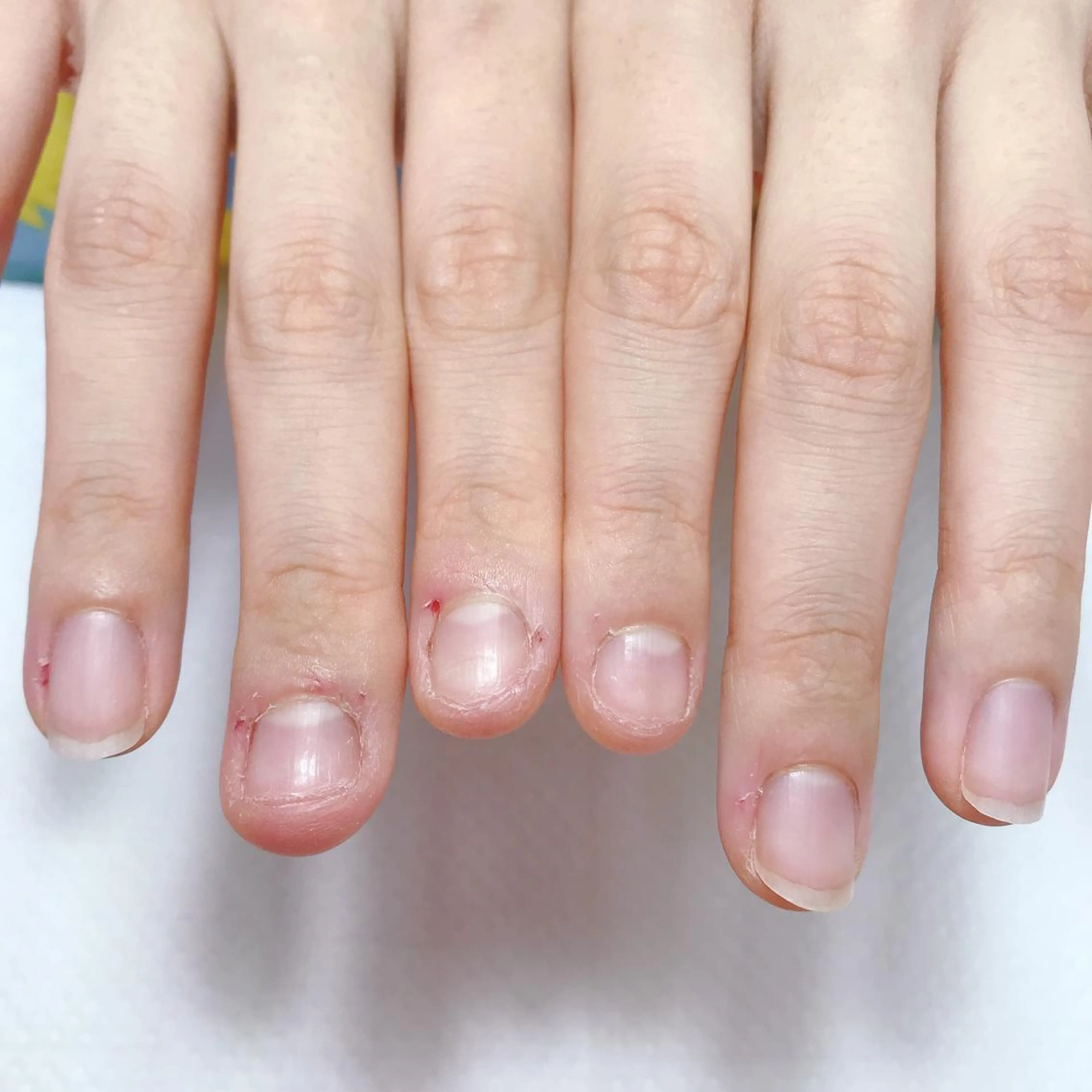 ネイル ハンドネイル 深爪を断らない スカルプ高評価店のネイルデザイン