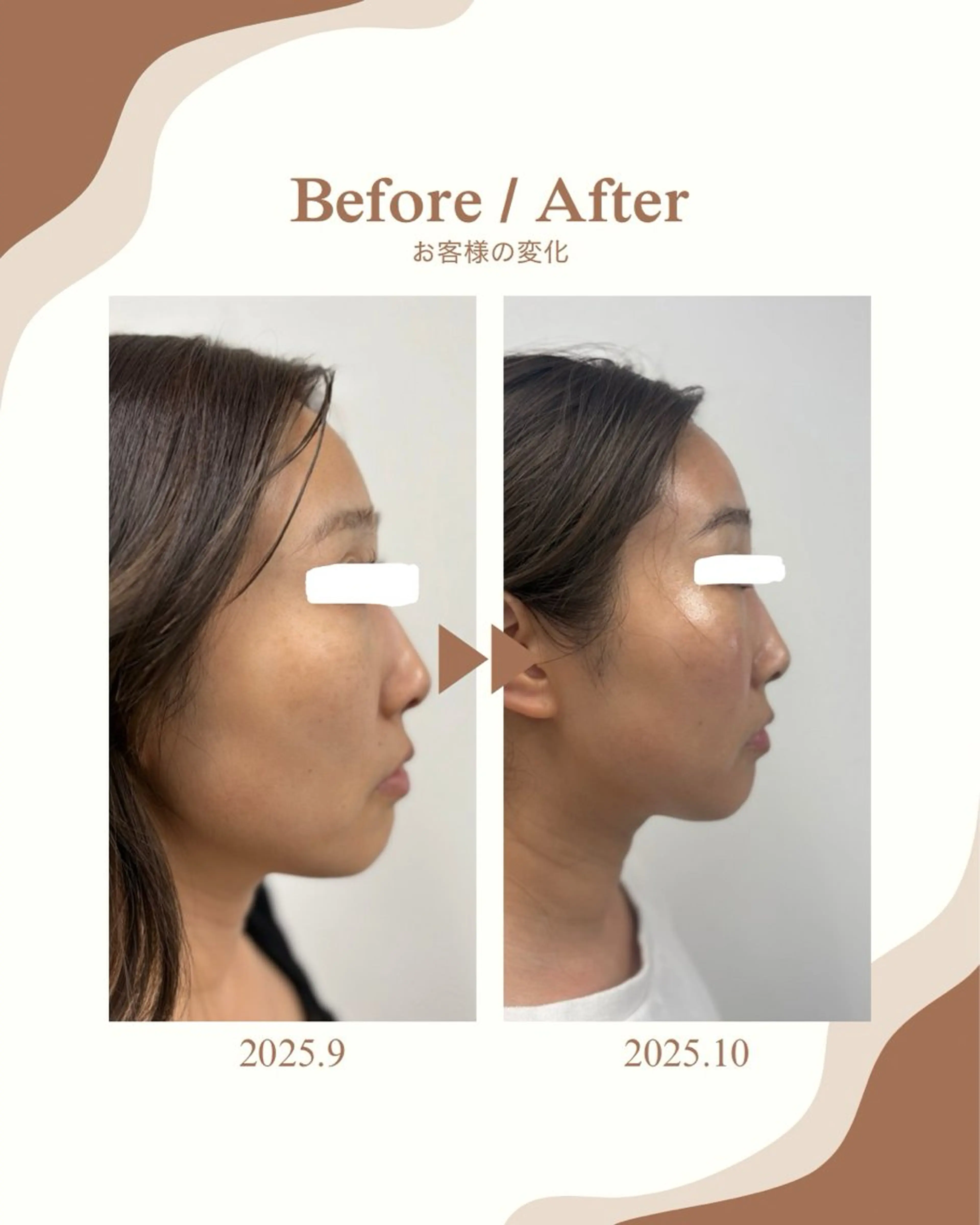 skinLabo所属・saya Mのエステ・リラクイメージ