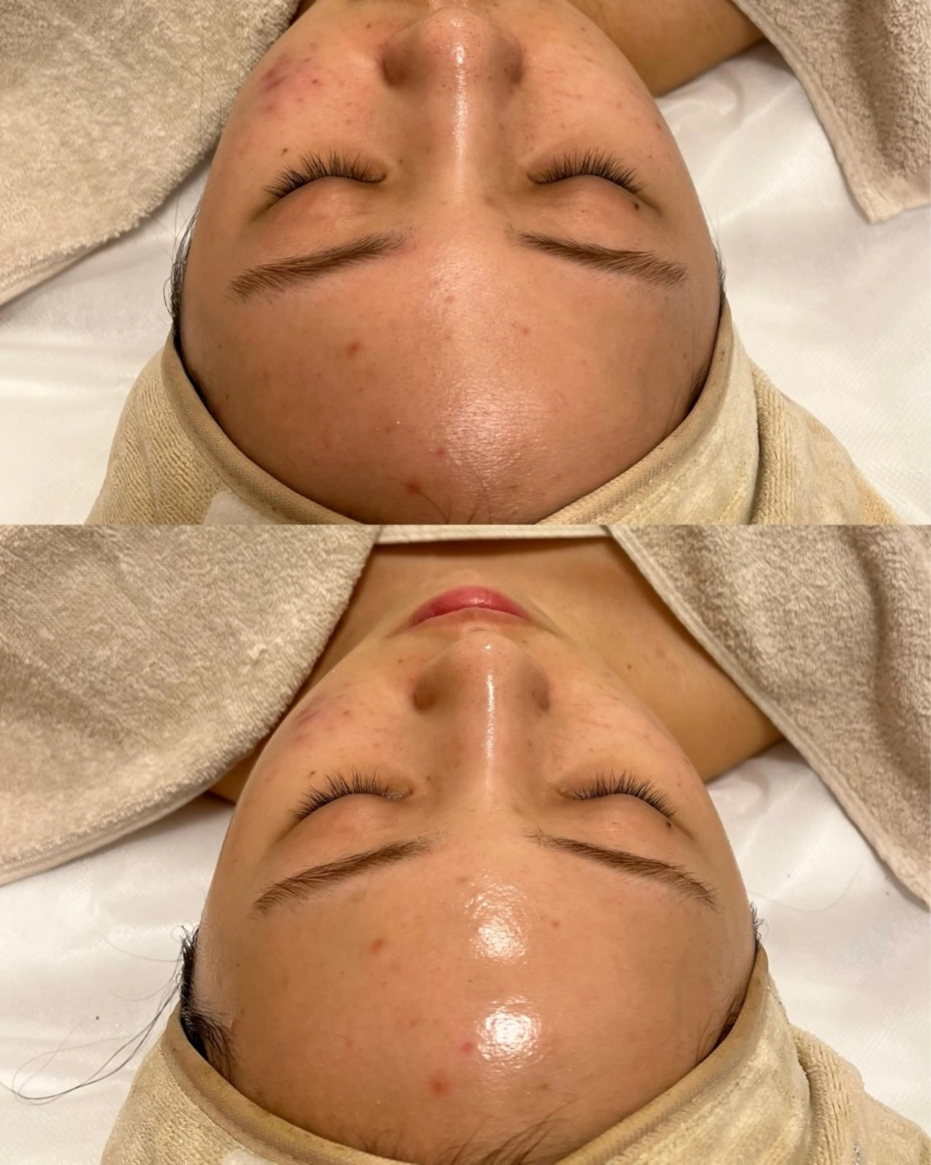 エステ mumu Rちゃんのエステ・リラクイメージ