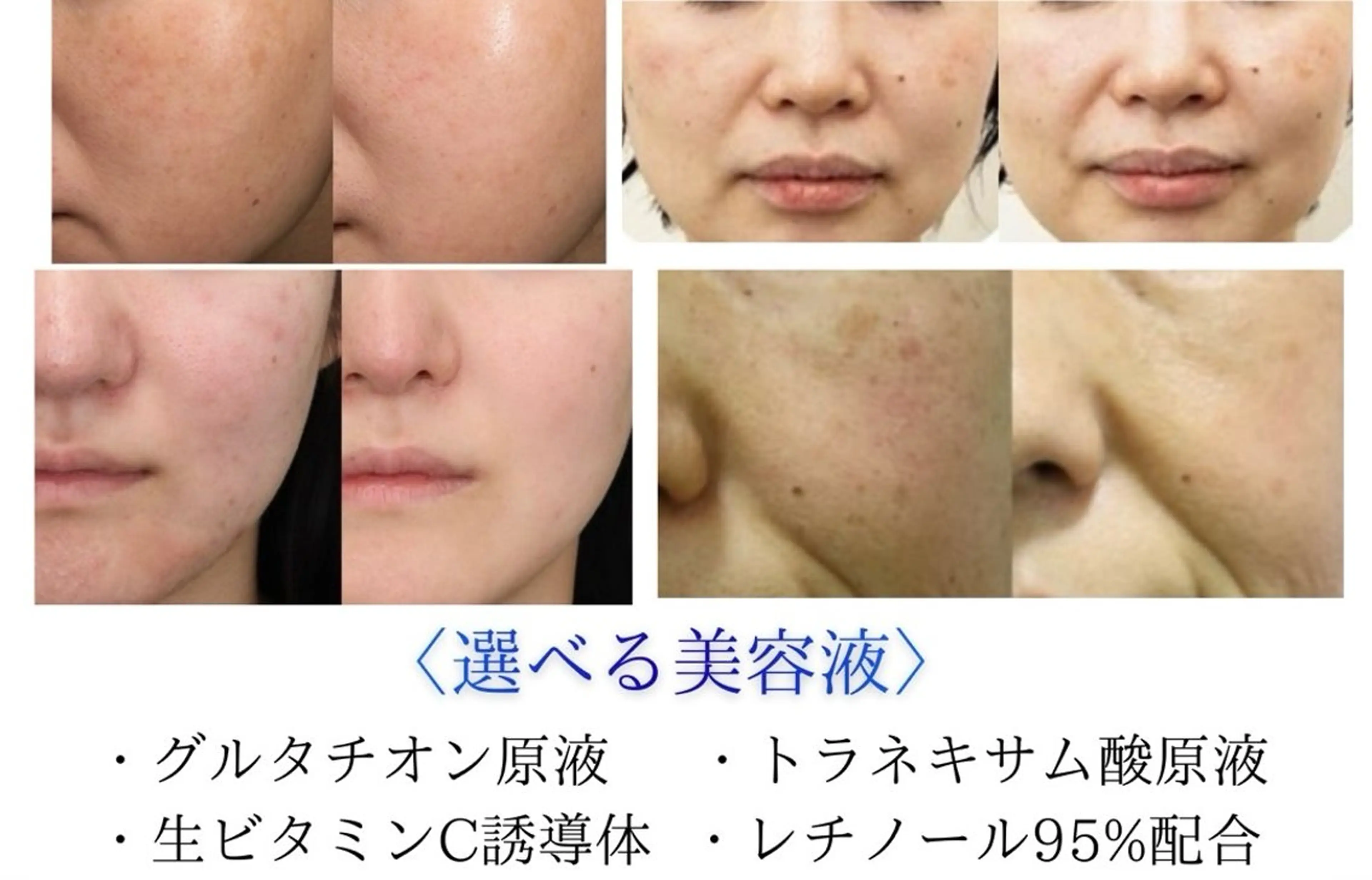 4つの美容液から選べるイオン導入💆♀️✨の写真