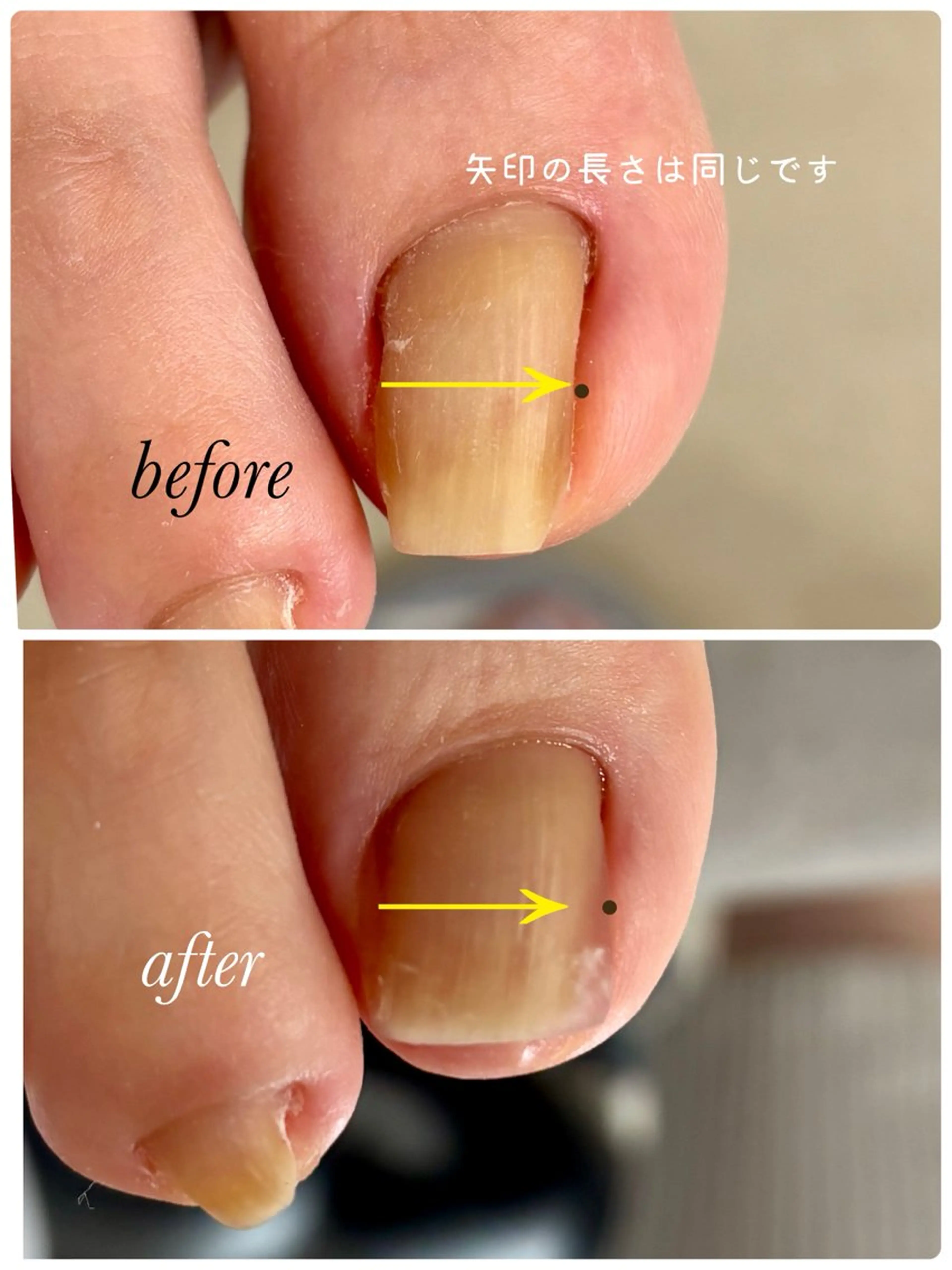 メンズ ネイル Chérinail 爪のお手入れのネイルデザイン