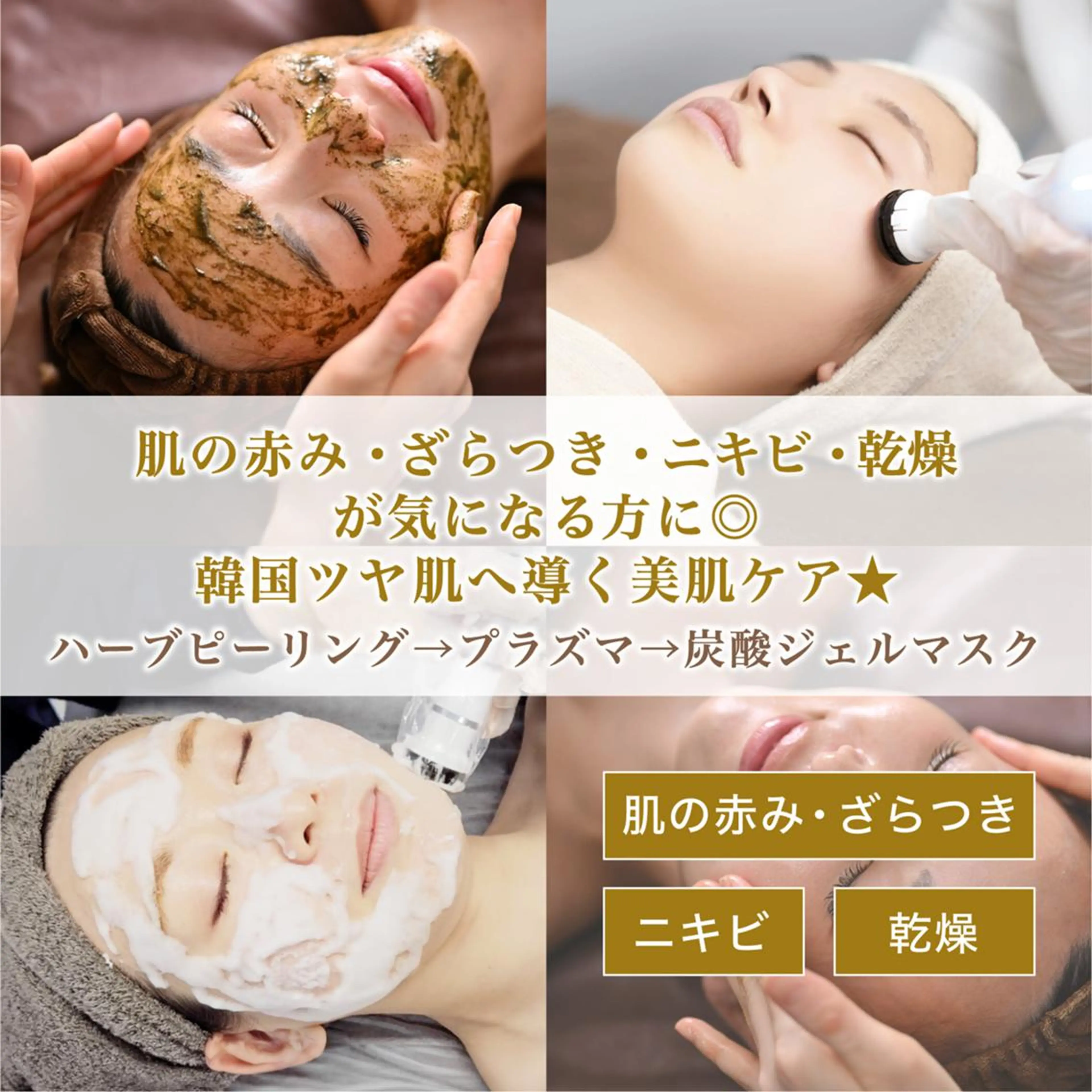 【ニキビ、ニキビ跡◎】プラズマ×剥離なしハーブピーリングでちゅるちゅる美肌へ🌿🫧炭酸パック&ヒアルロン酸導入付き🩵の写真