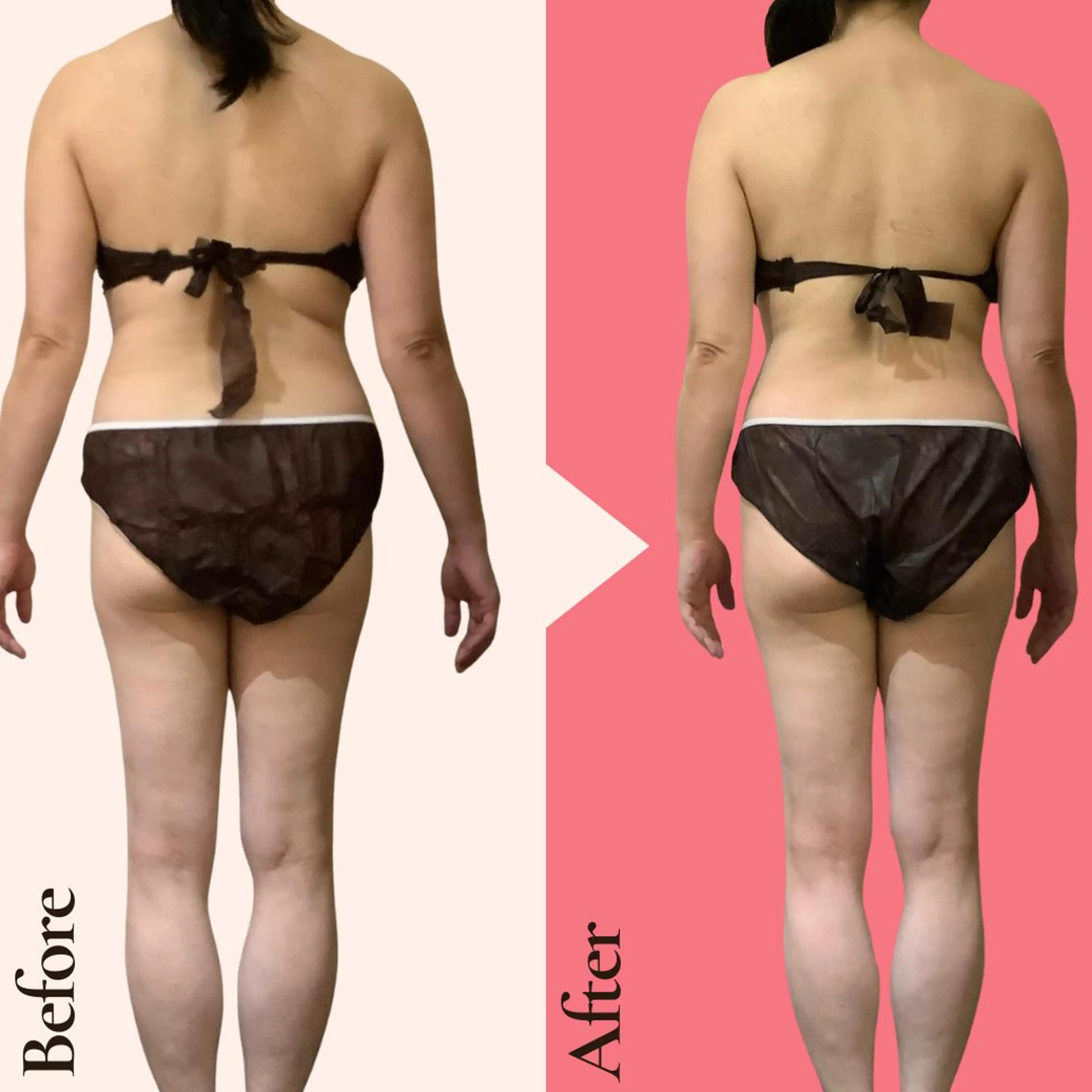 痩身ダイエット専門店 プレシャスのエステ・リラクイメージ