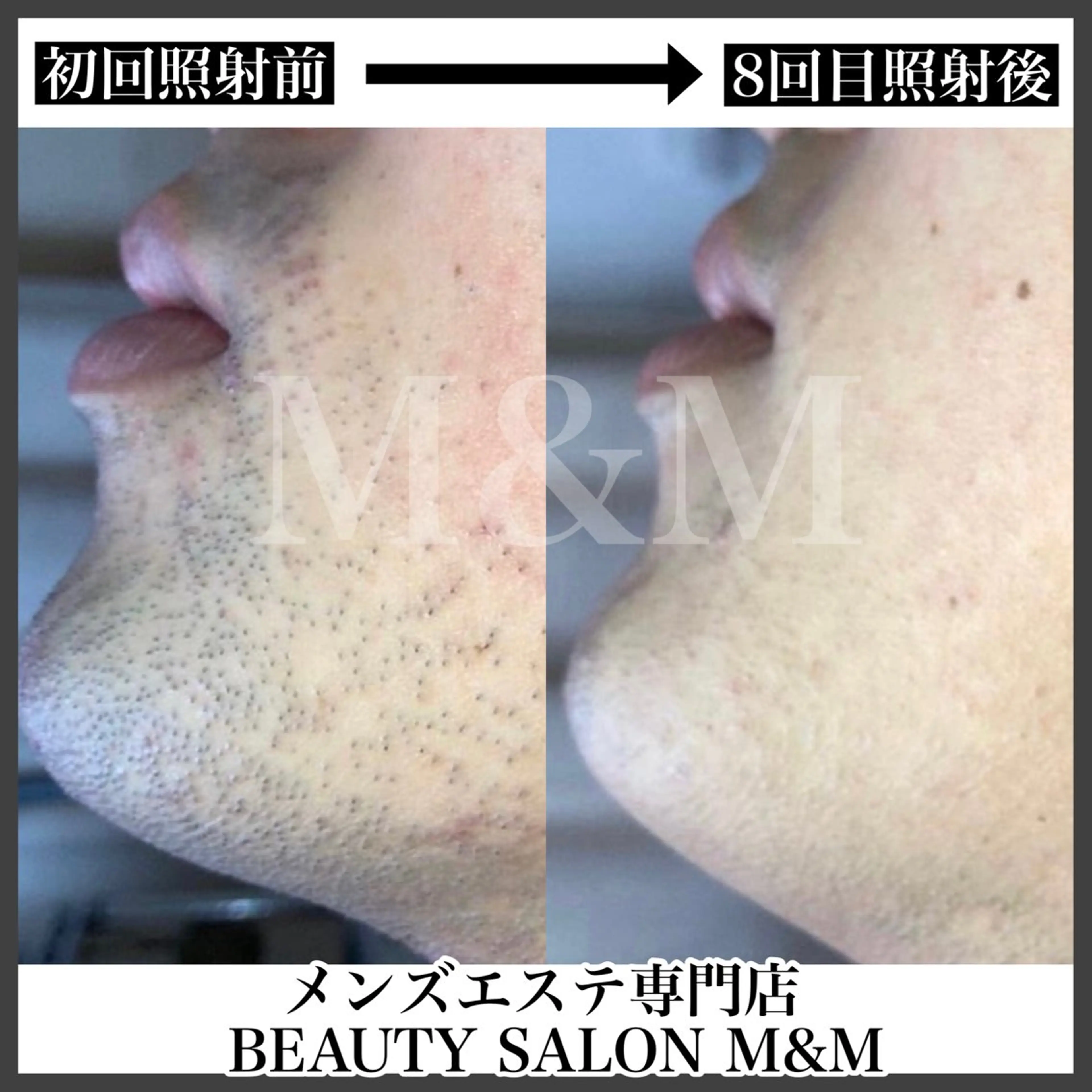 脱毛 大野 満広のエステ・リラクイメージ