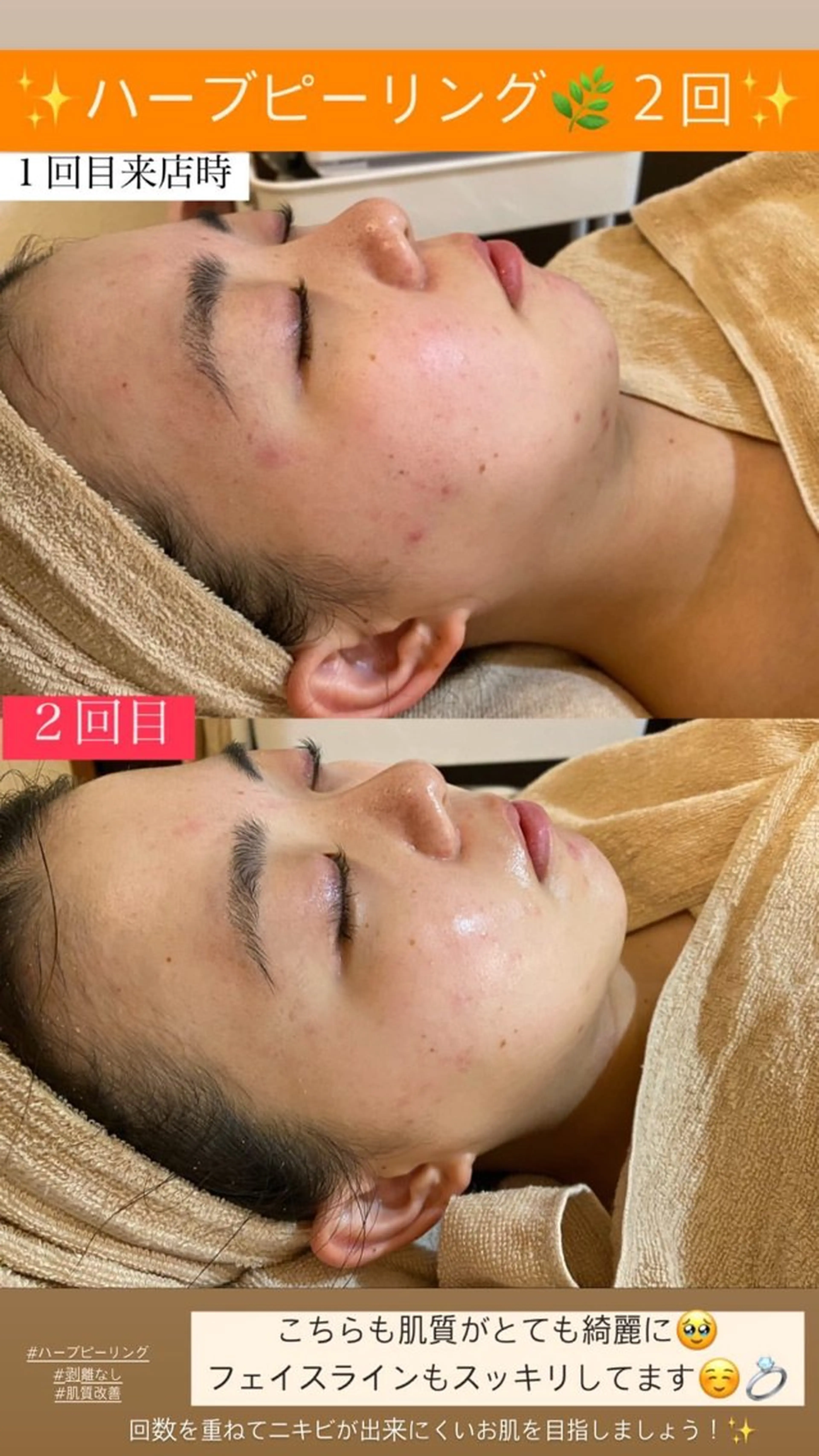 エステ Salon de Lino 御器所のエステ・リラクイメージ