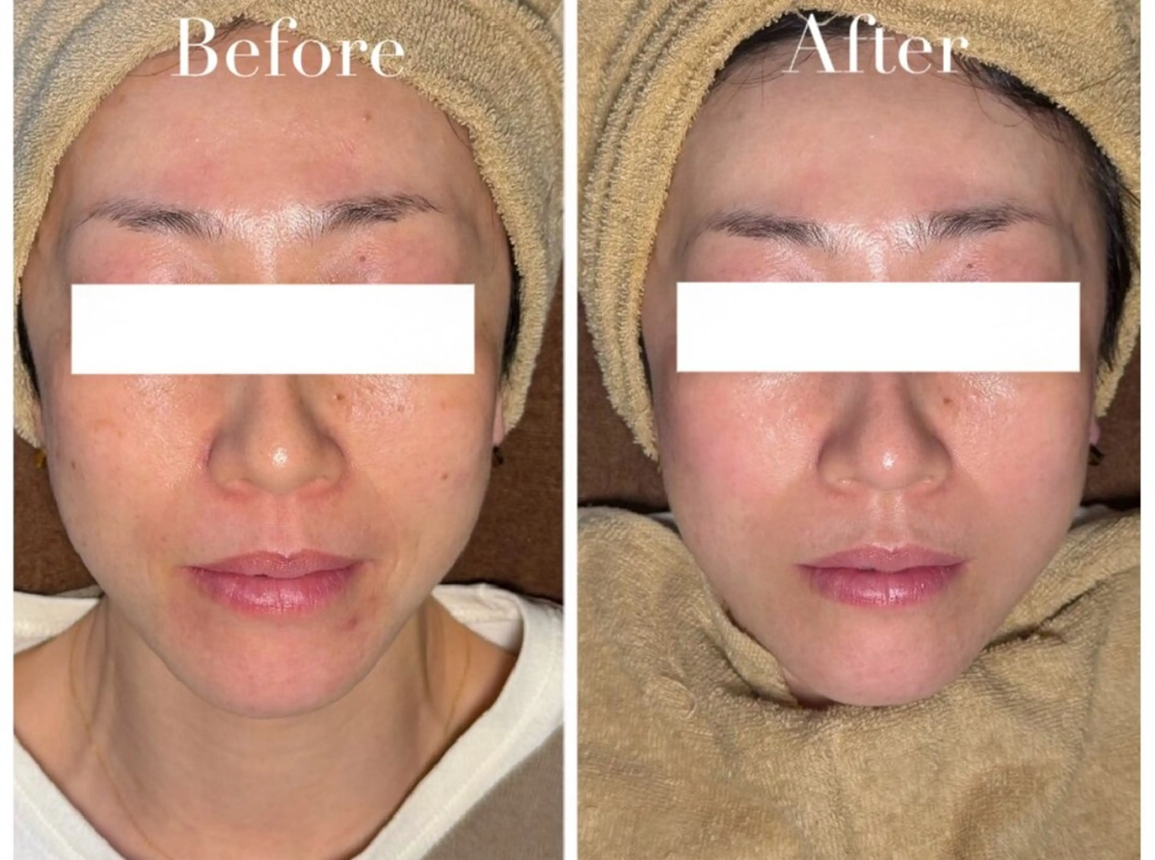 エステ 松田 紗季のエステ・リラクイメージ