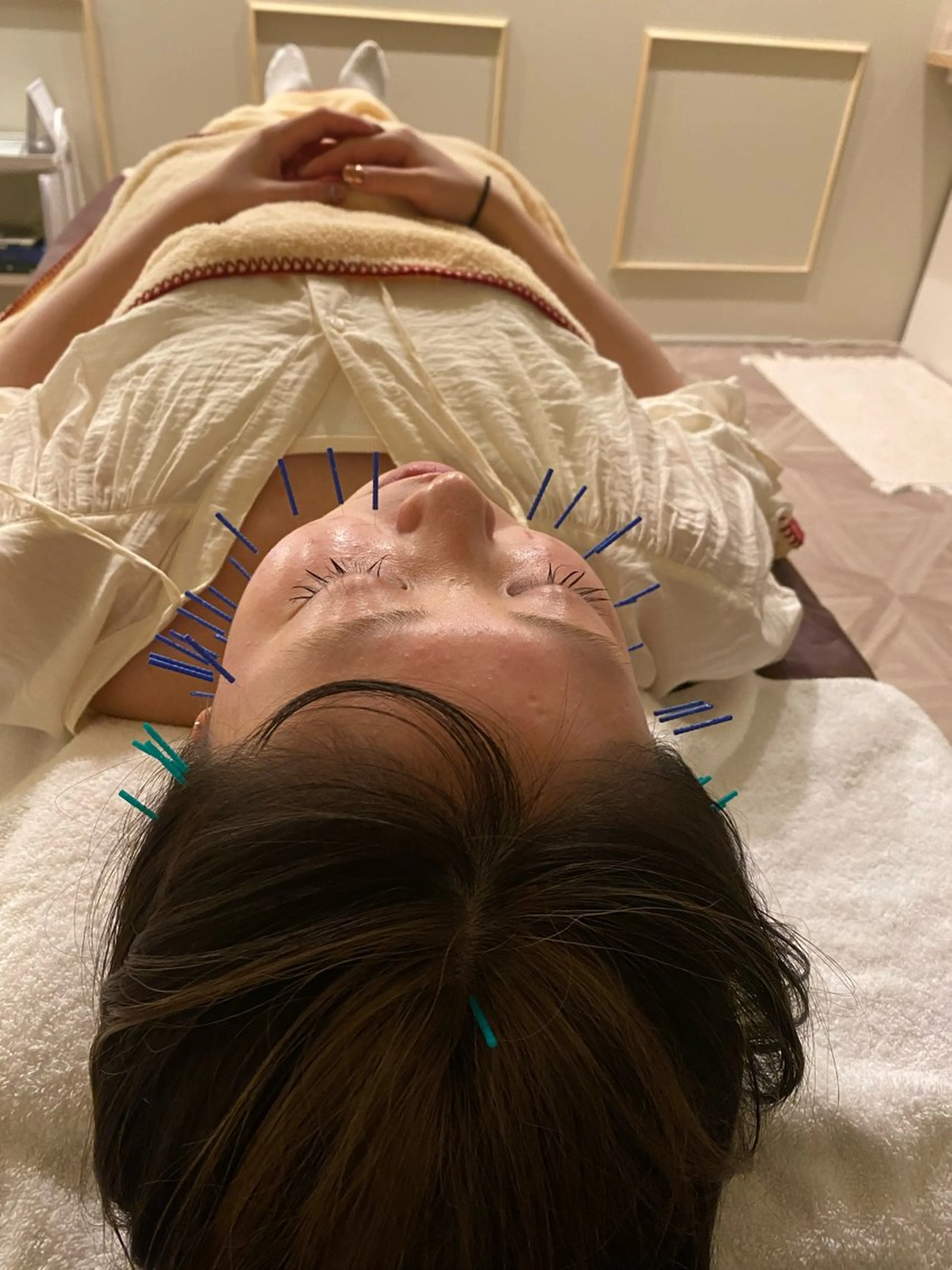 美容鍼/ヘッドスパ/ 💎さかもとのエステ・リラクイメージ