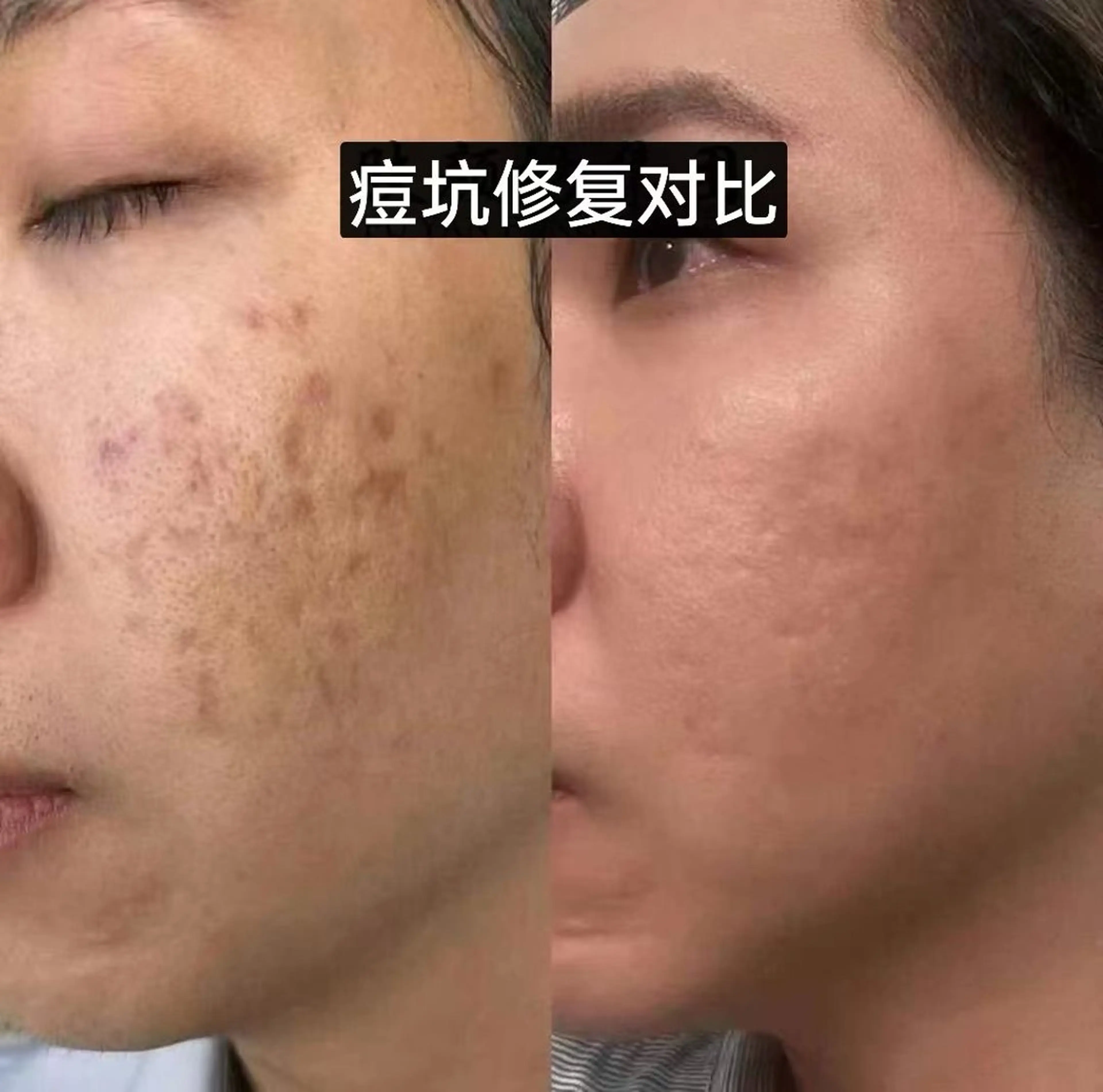 マツエク・マツパ エステ リラク aliaハーブ水光店 エステティシャン募集のエステ・リラクイメージ