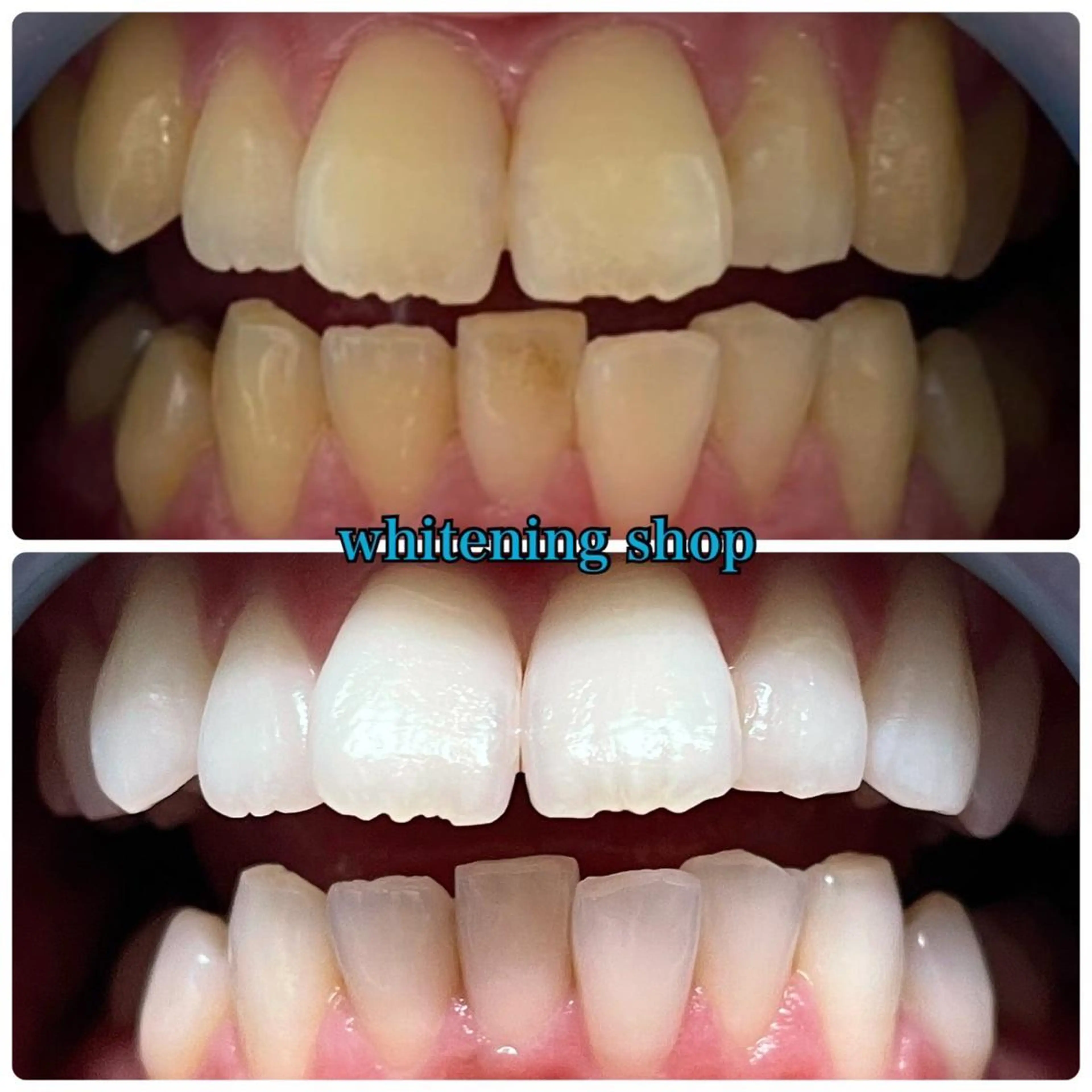 その他 ホワイトニング ショップ千葉店のその他イメージ